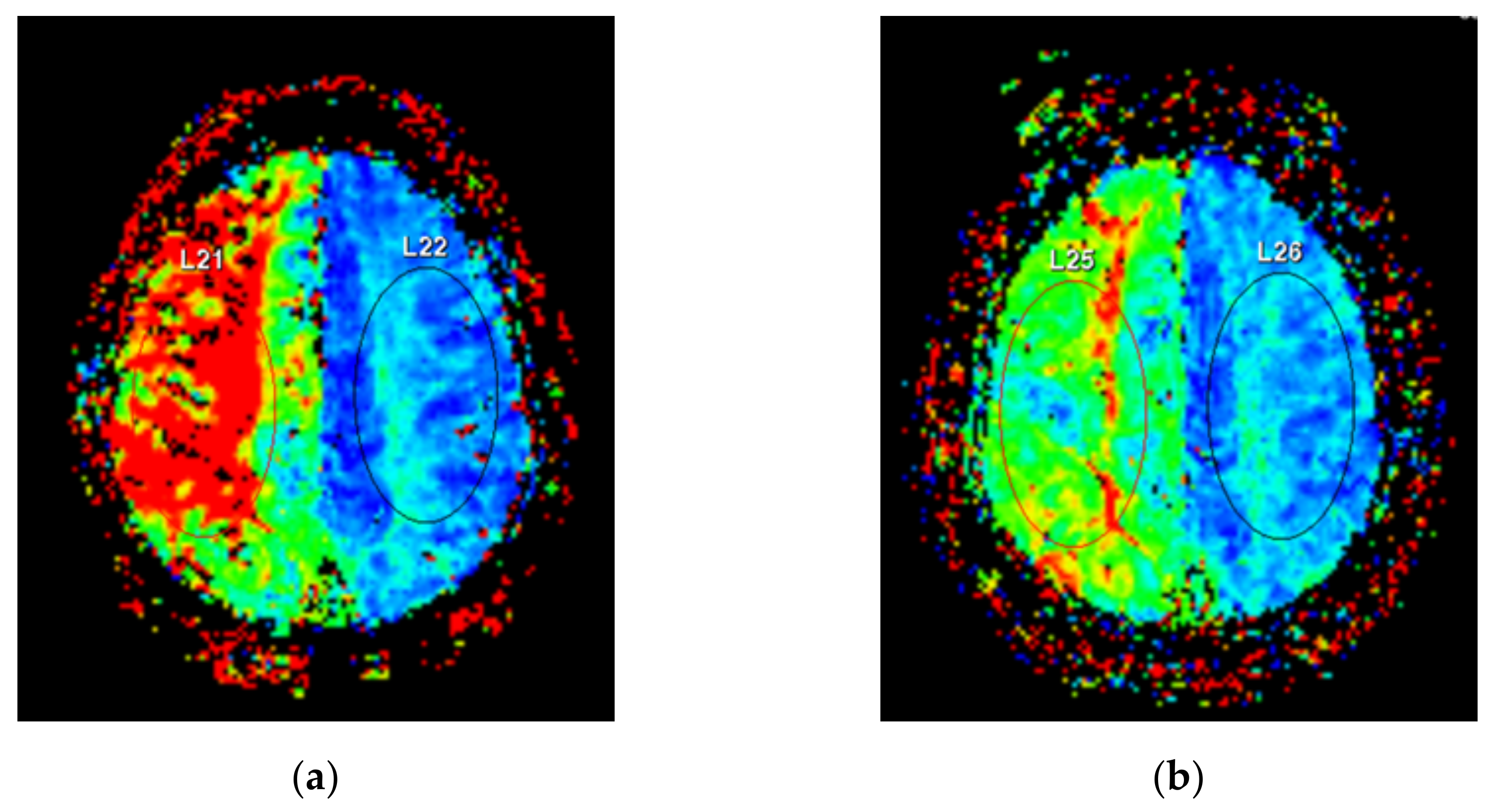 Brainsci 11 01478 g004