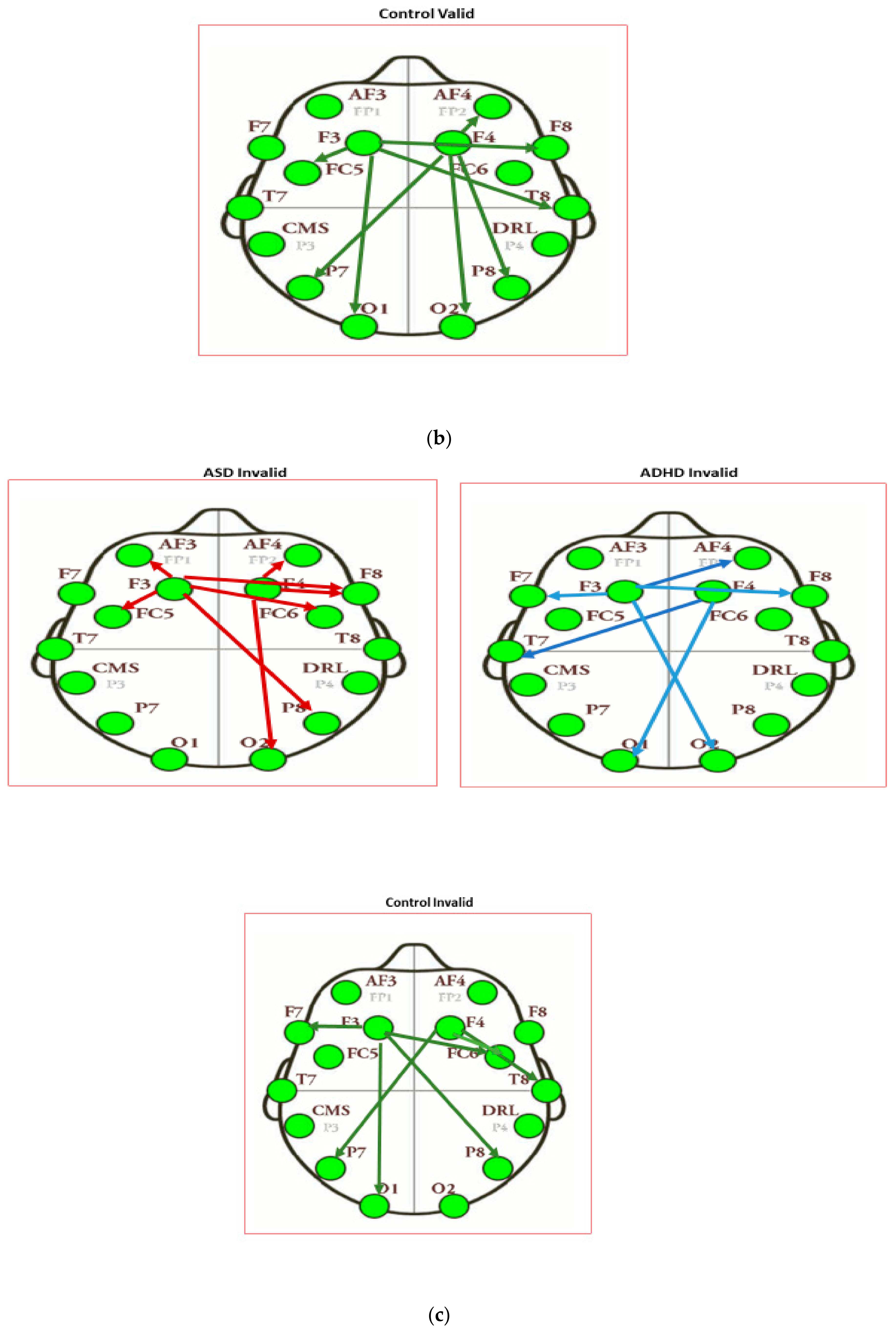Brainsci 11 01531 g031b Brainsci 11 01531 g031b