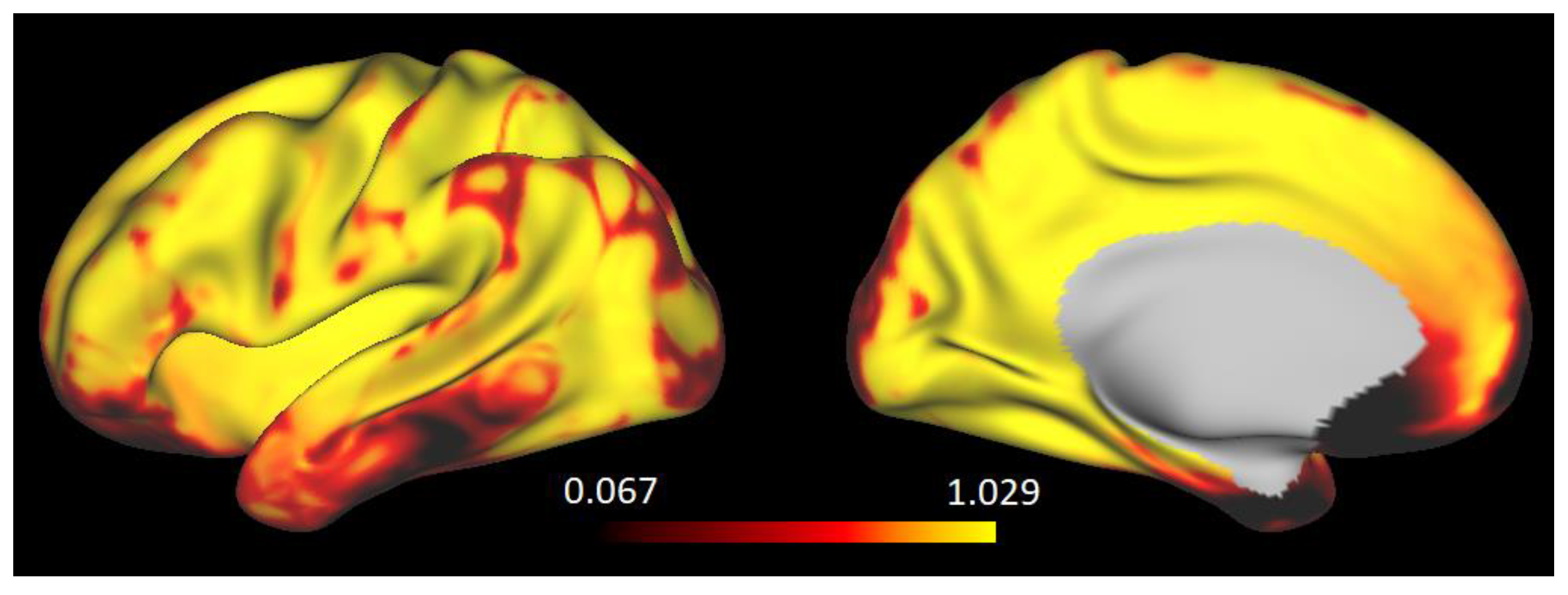 Brainsci 11 01565 g0a2