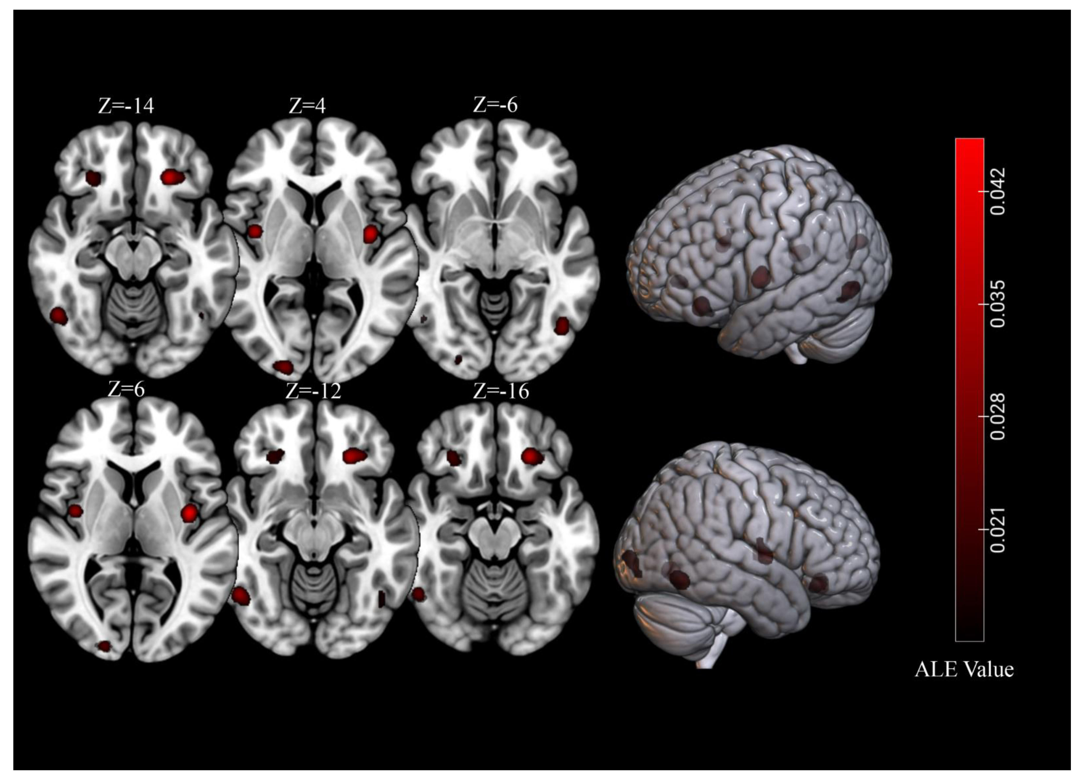 Not just scans and cognitive tests: Diet is an indicator of brain health -  OZ Arab Media