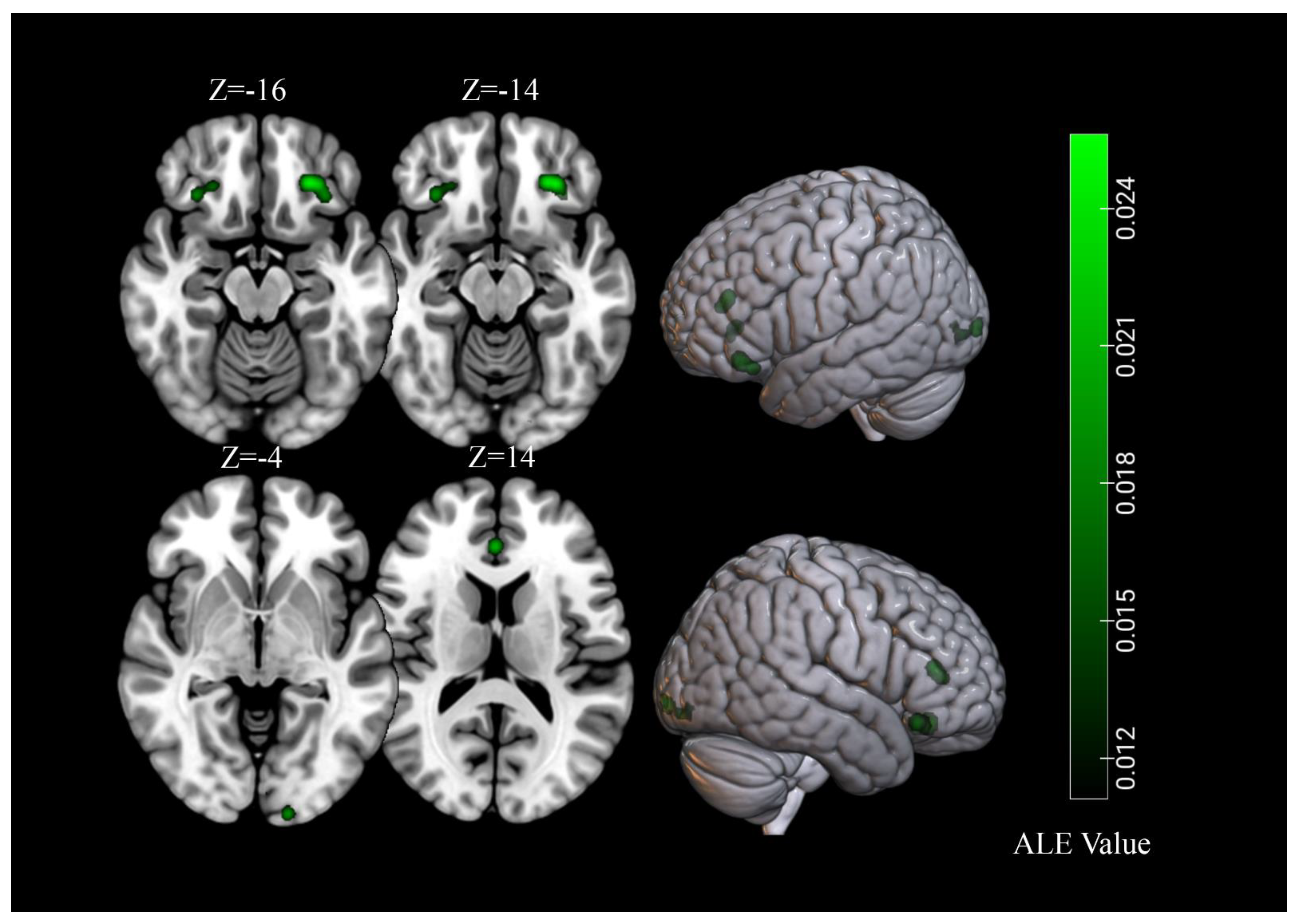Brainsci 11 01587 g004