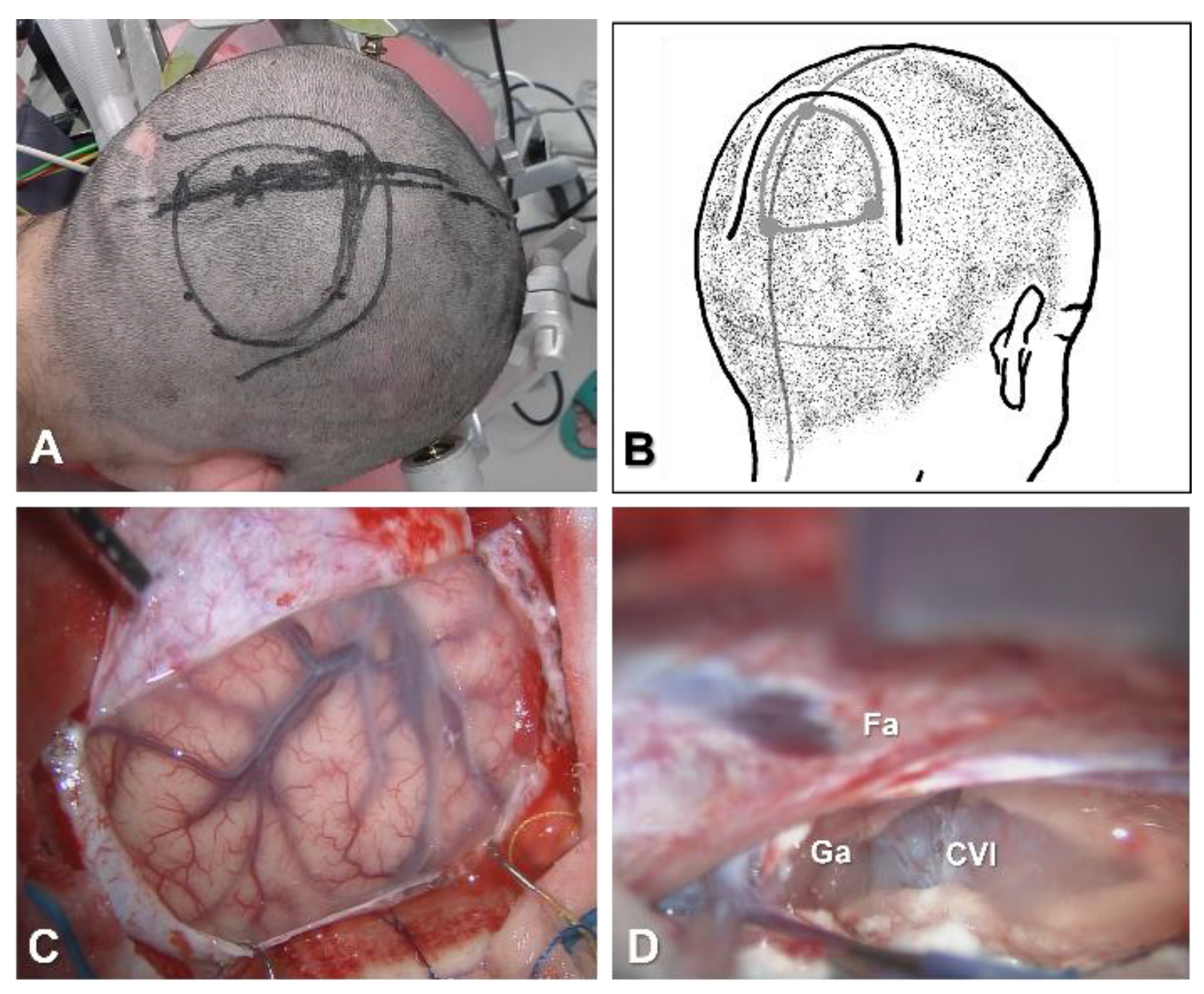 Brainsci 11 01608 g005