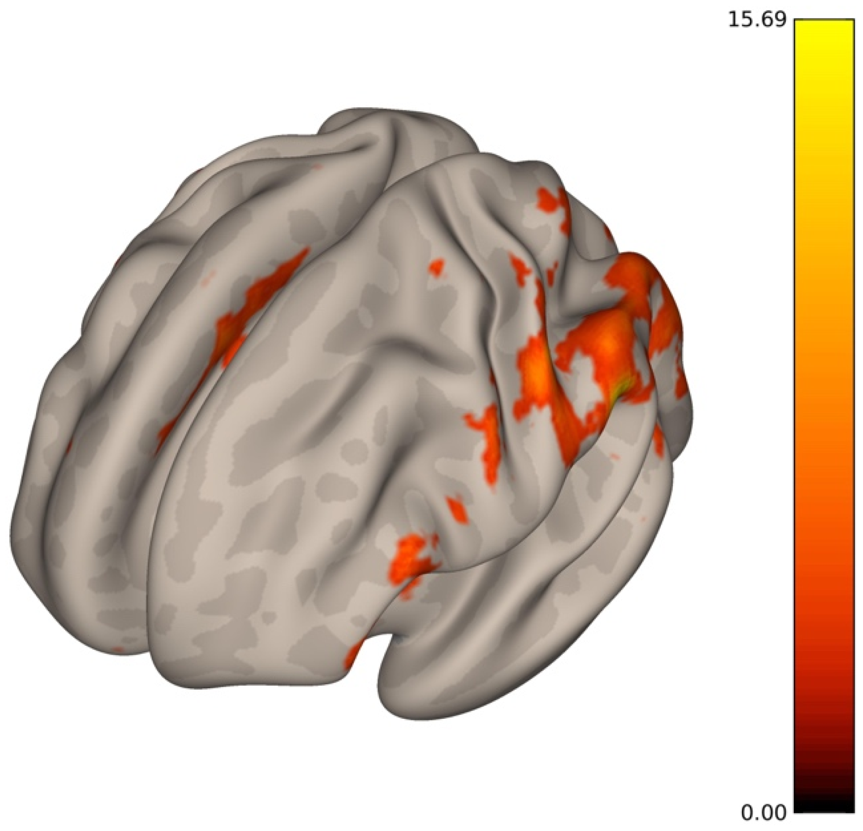 human brain mapping rossi