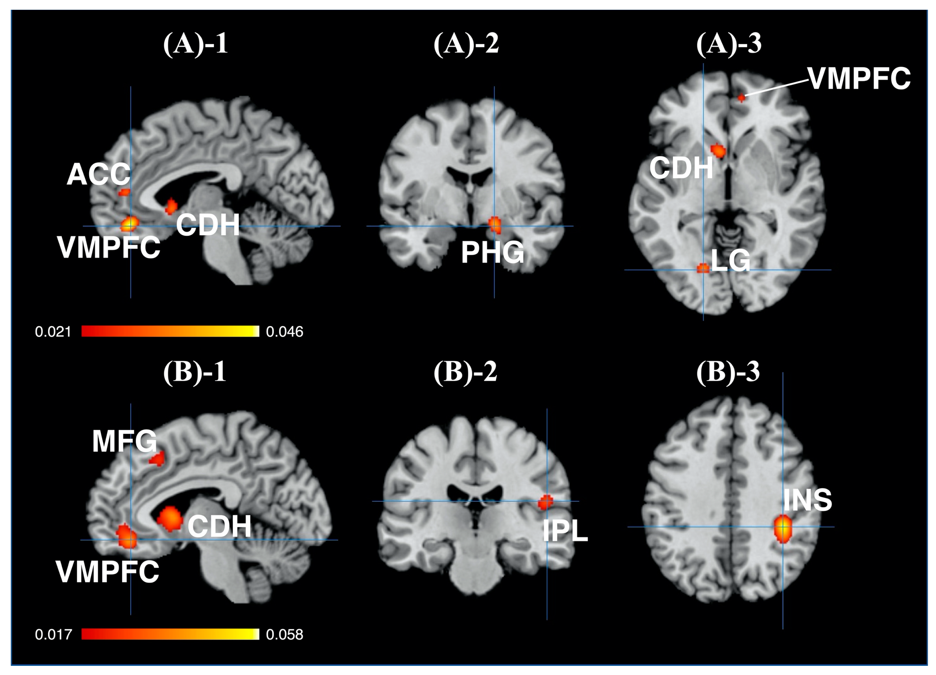 Brainsci 11 01619 g004