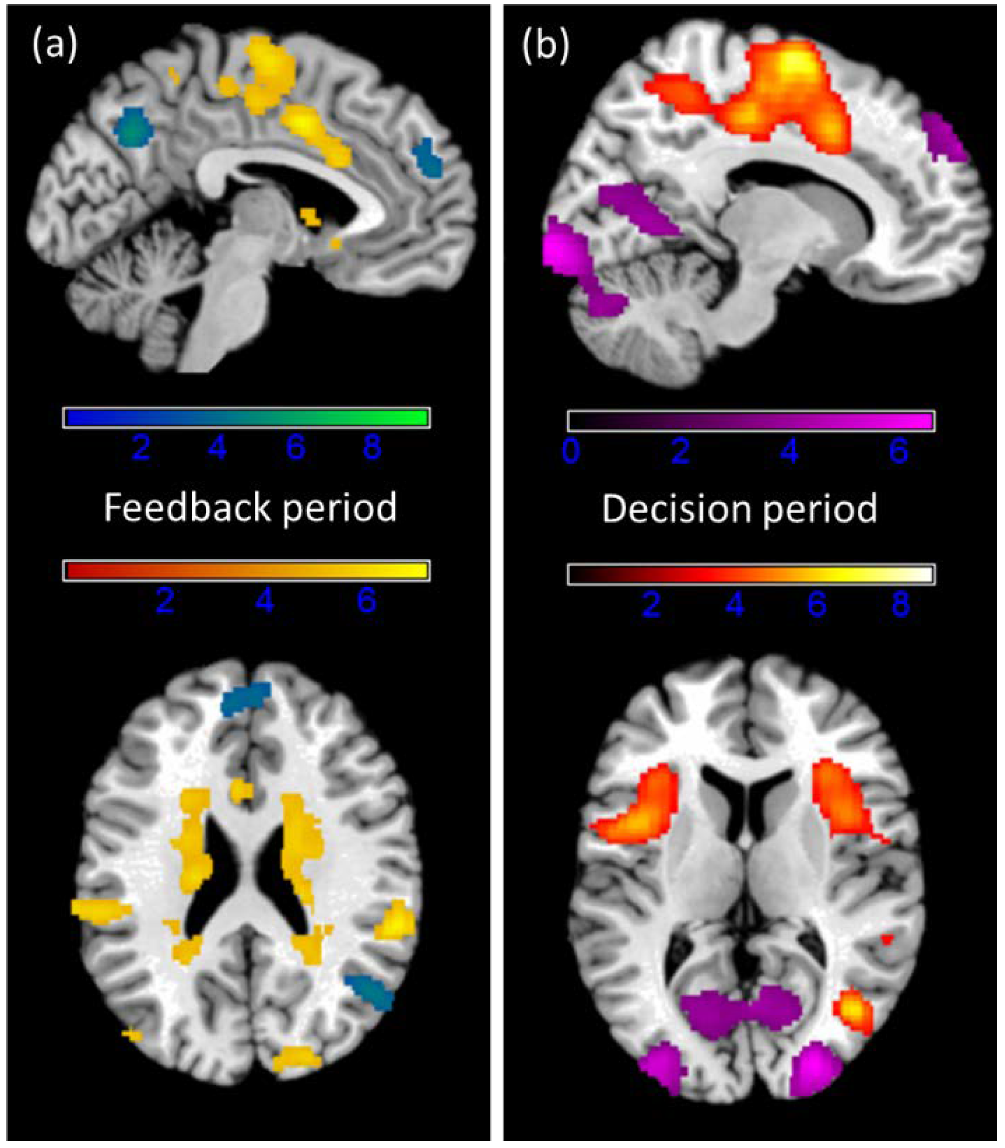 Brainsci 11 01623 g005
