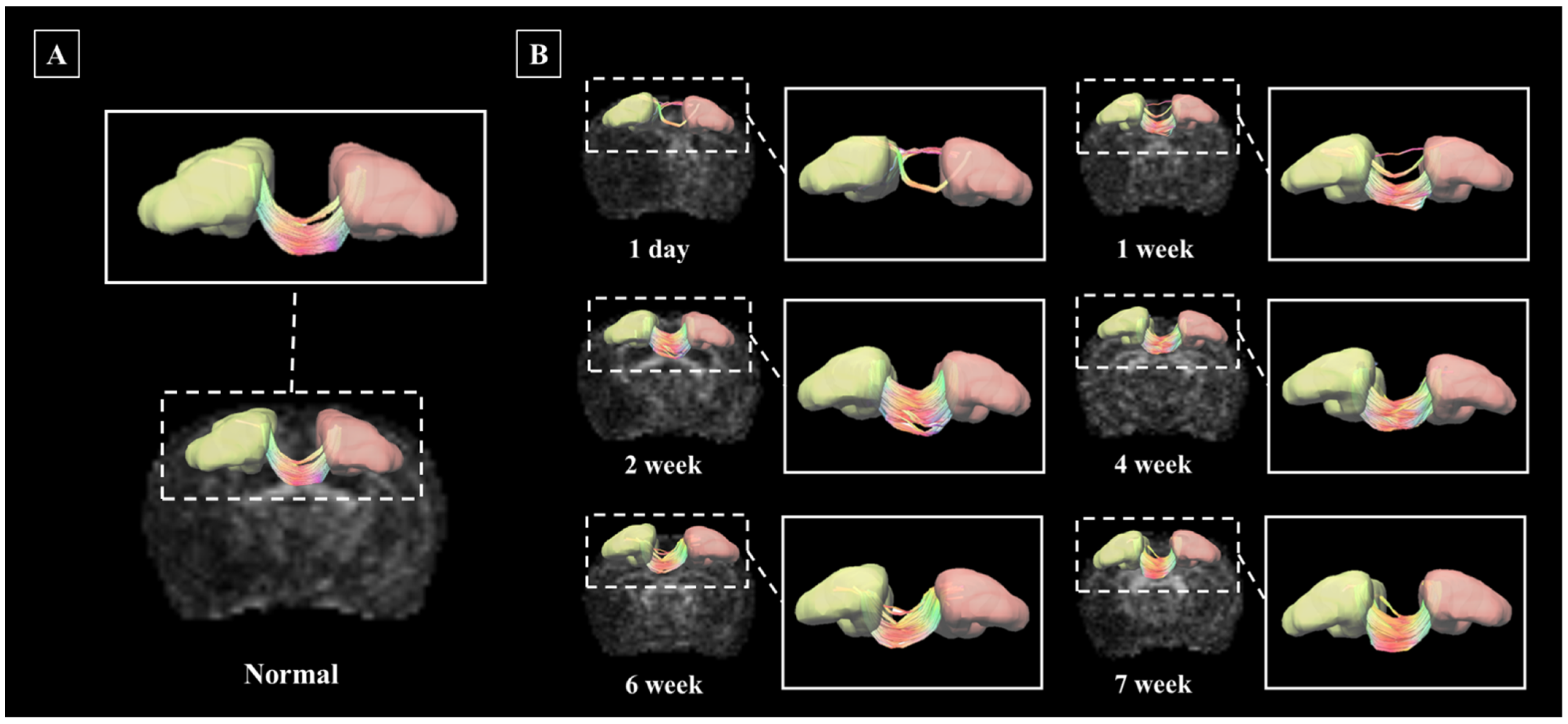 Brainsci 11 01656 g006 Brainsci 11 01656 g006