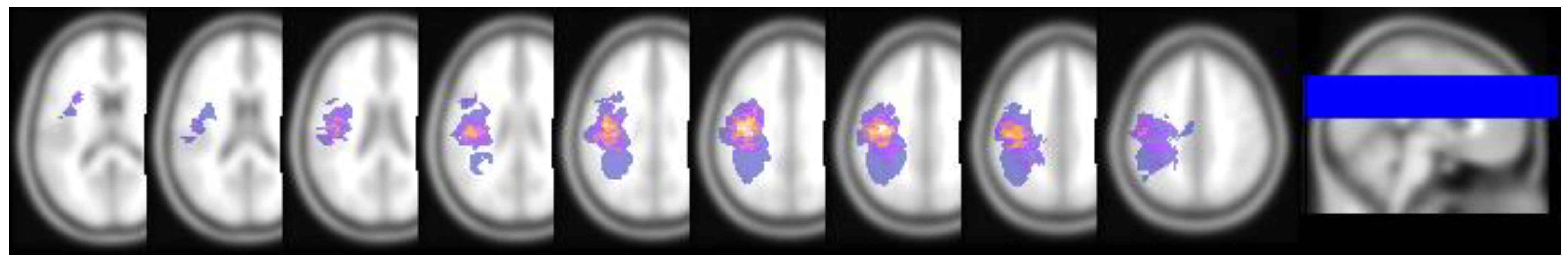 Brainsci 12 00060 g002