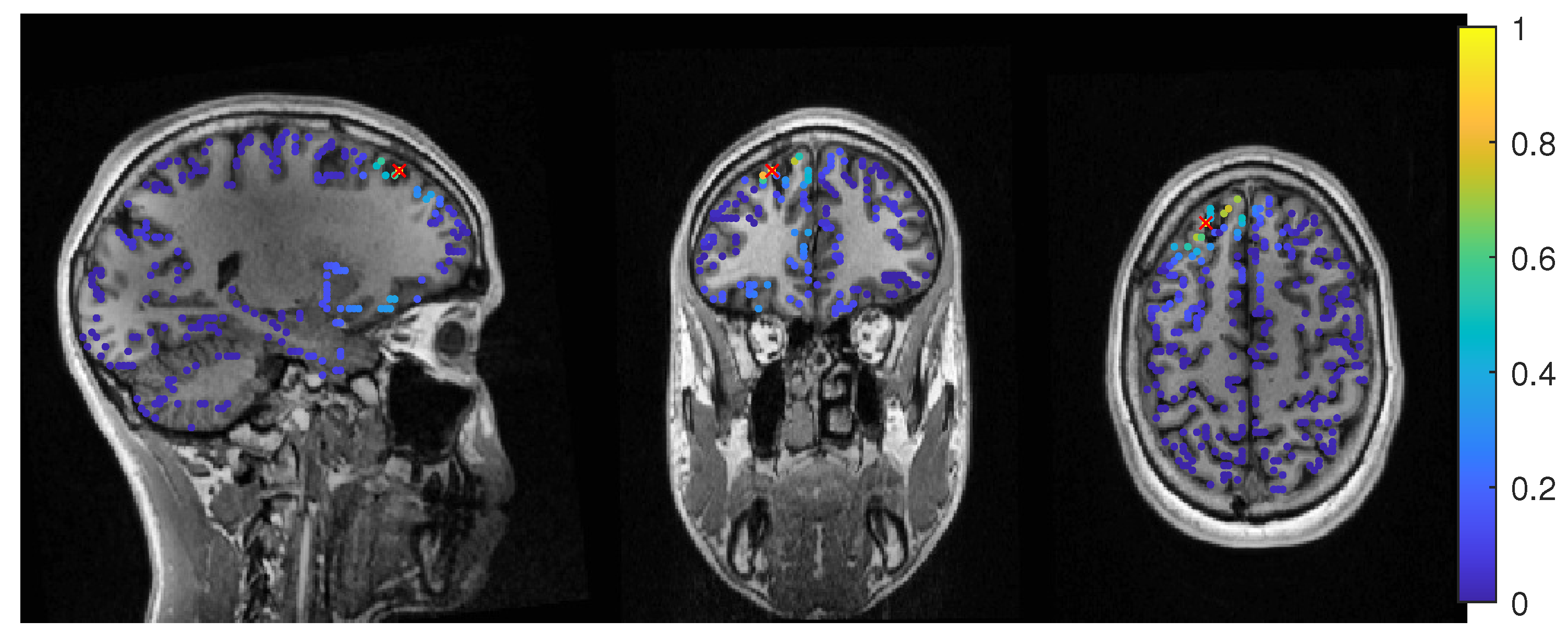 eeg brain scan