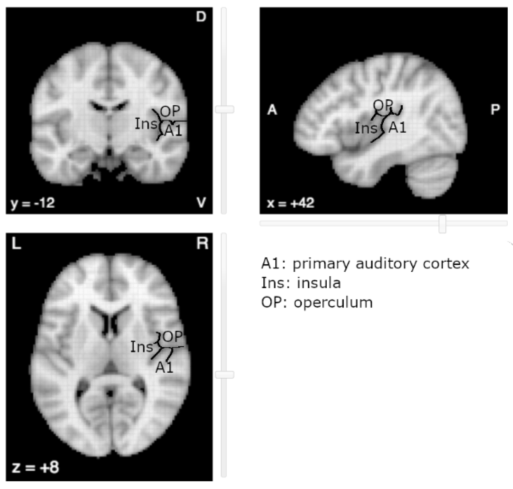 human brain mapping best practices mri white papers