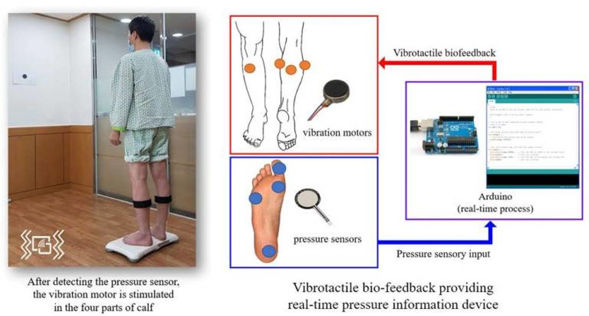 Brain Sciences Free Full-Text Effects of Vibrotactile Biofeedback Providing Real-Time Pressure Information on Static Balance Ability and Weight Distribution Symmetry Index in Patients with Chronic Stroke
