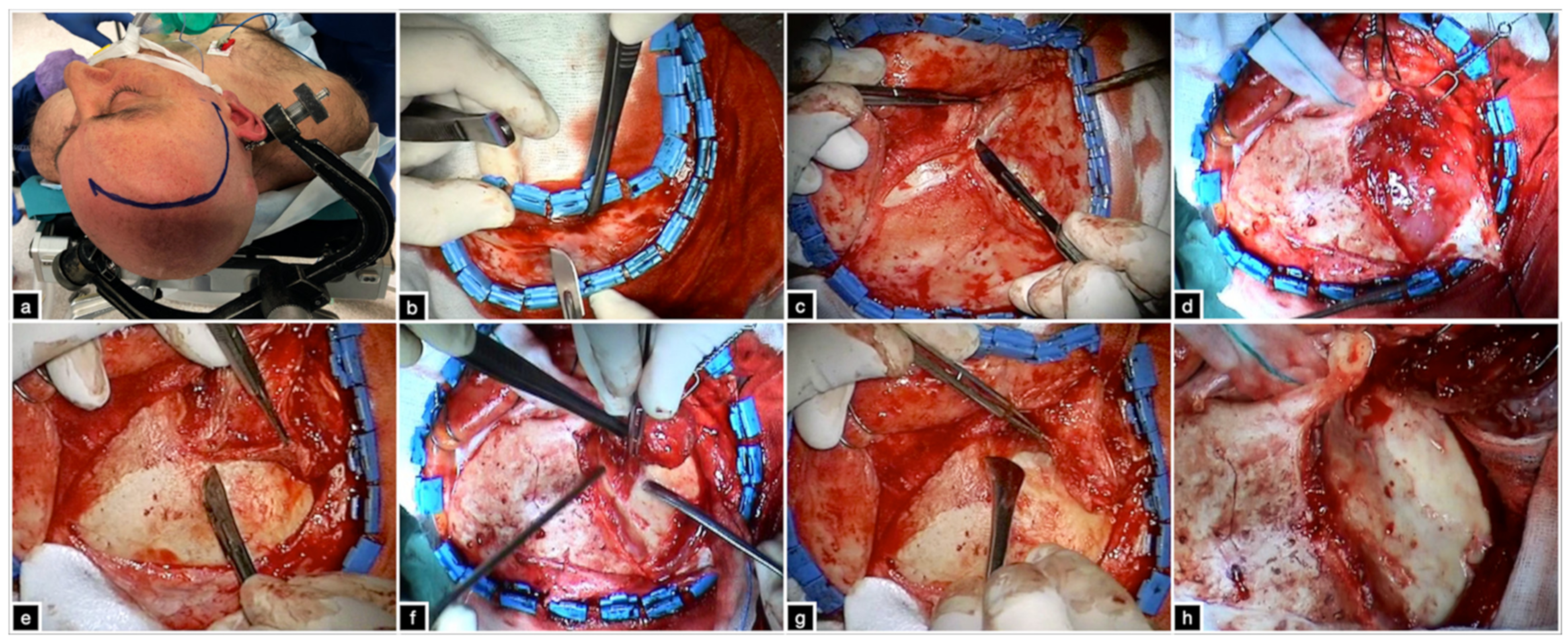 Brainsci 12 00405 g002