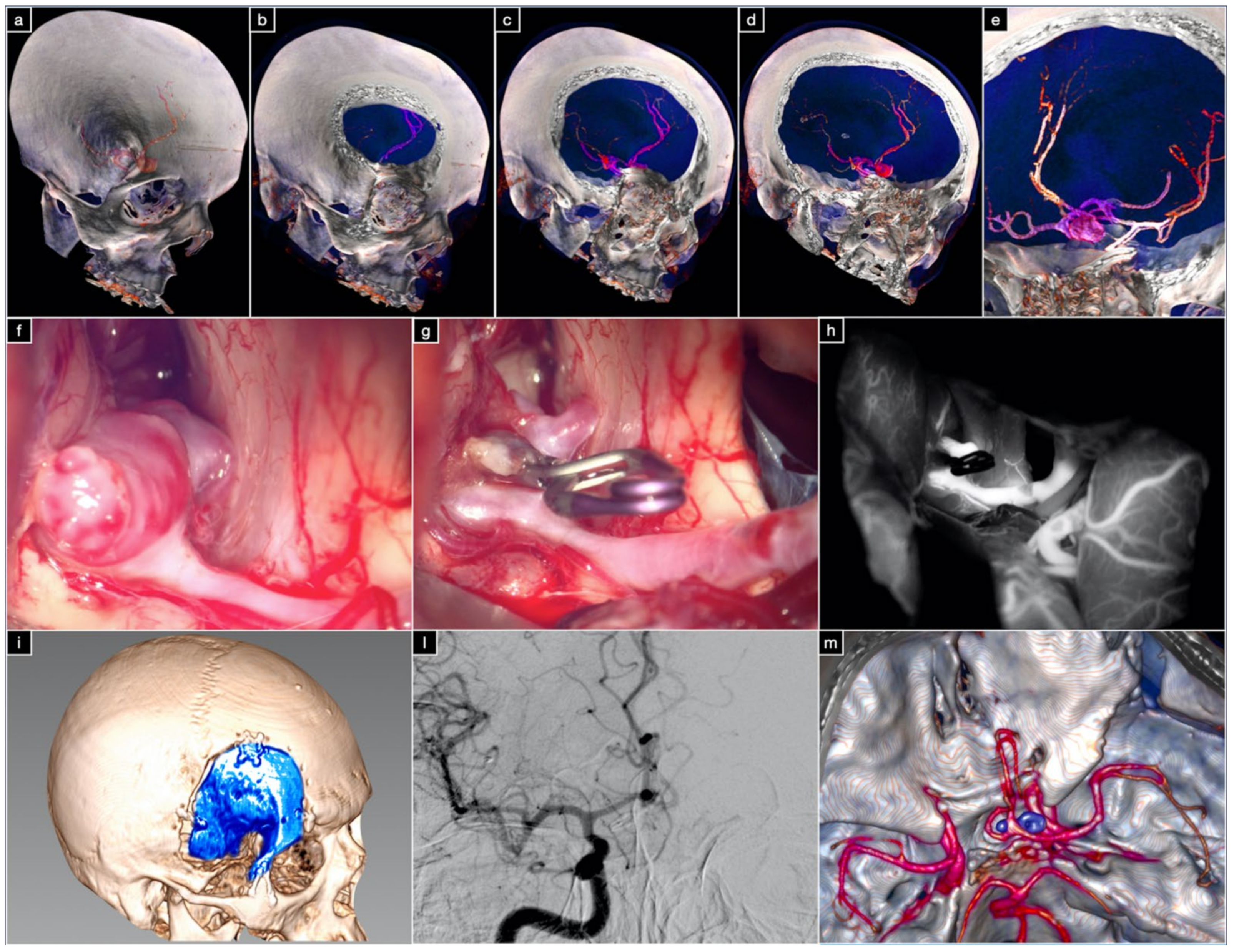 Brainsci 12 00405 g008