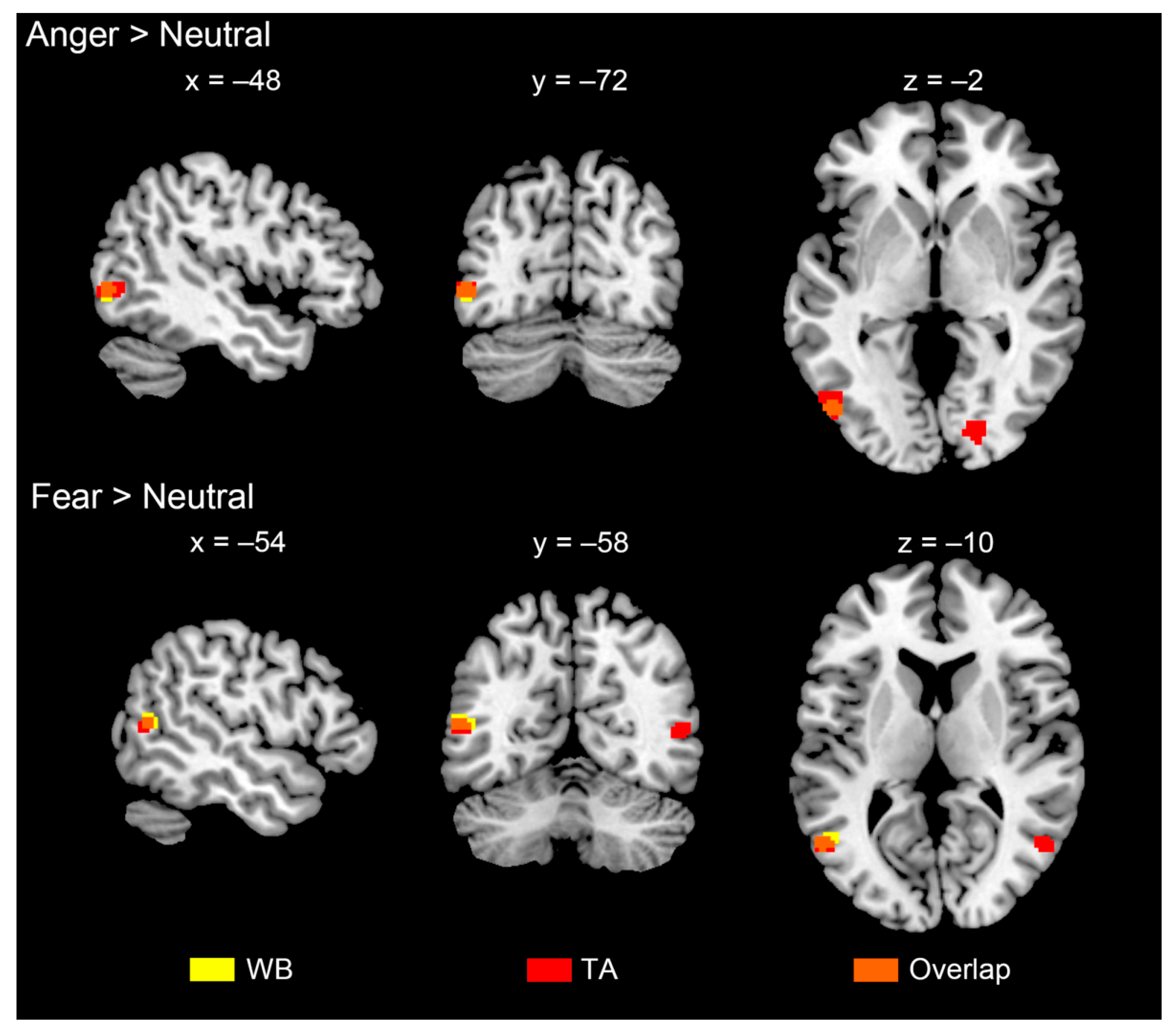 Brain Sciences Free Full Text Features And Extra Striate Body Area Representations Of 