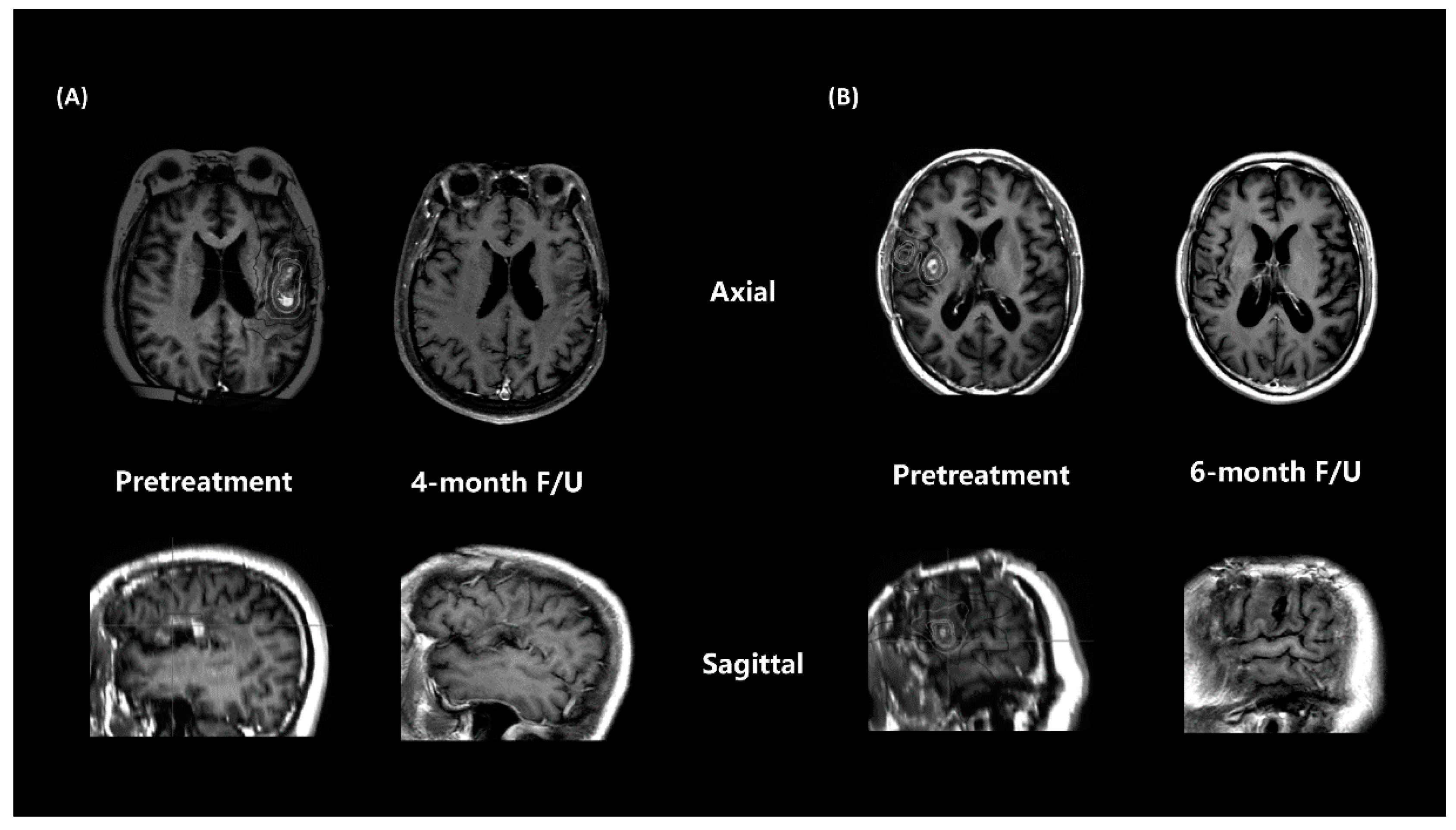 Brainsci 12 00471 g002
