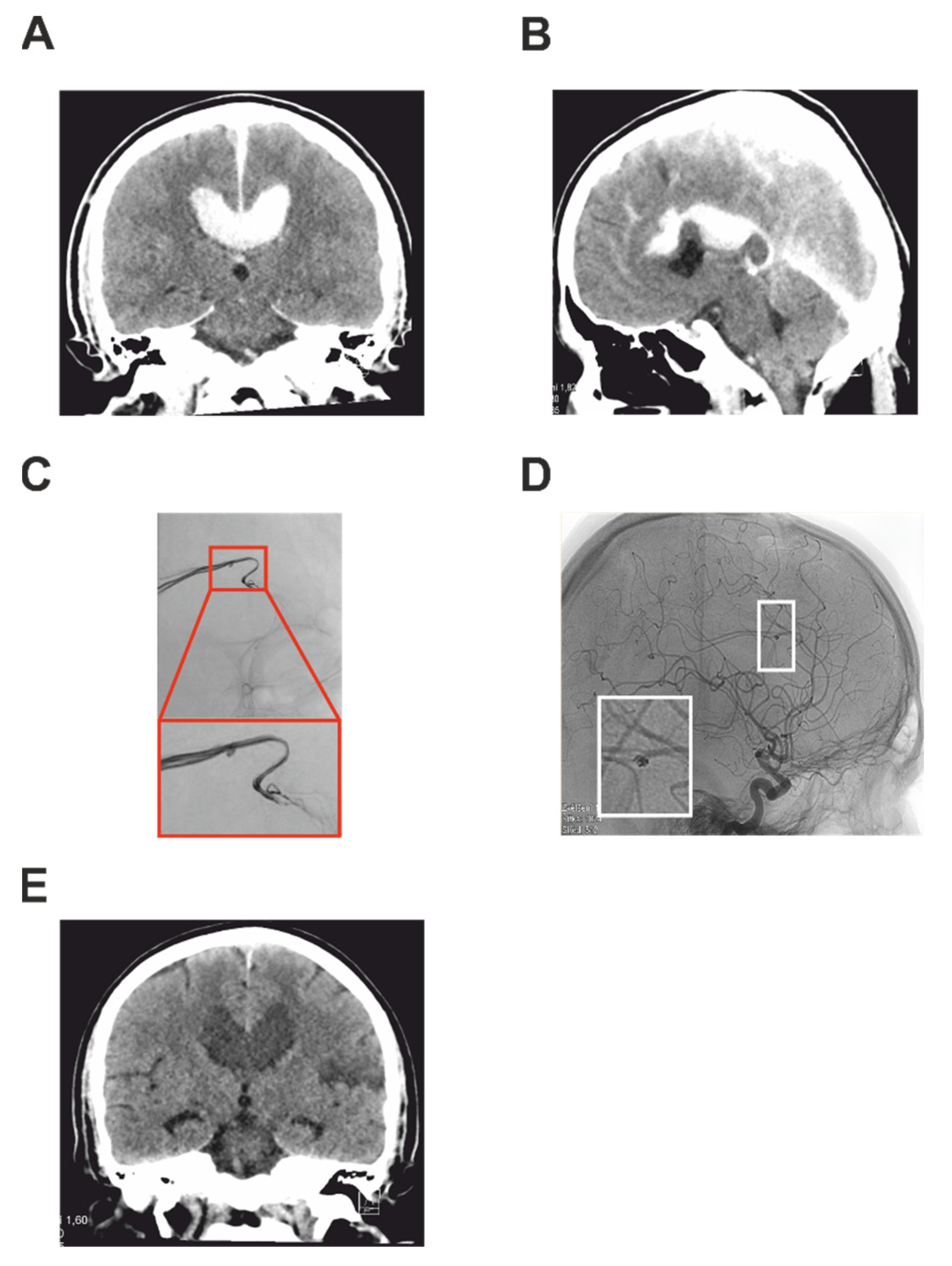 Brainsci 12 00634 g002