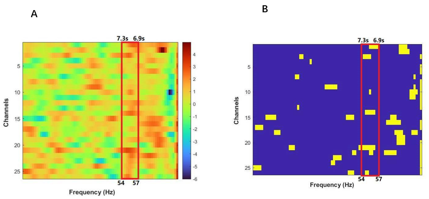 Brainsci 12 00635 g003 Brainsci 12 00635 g003