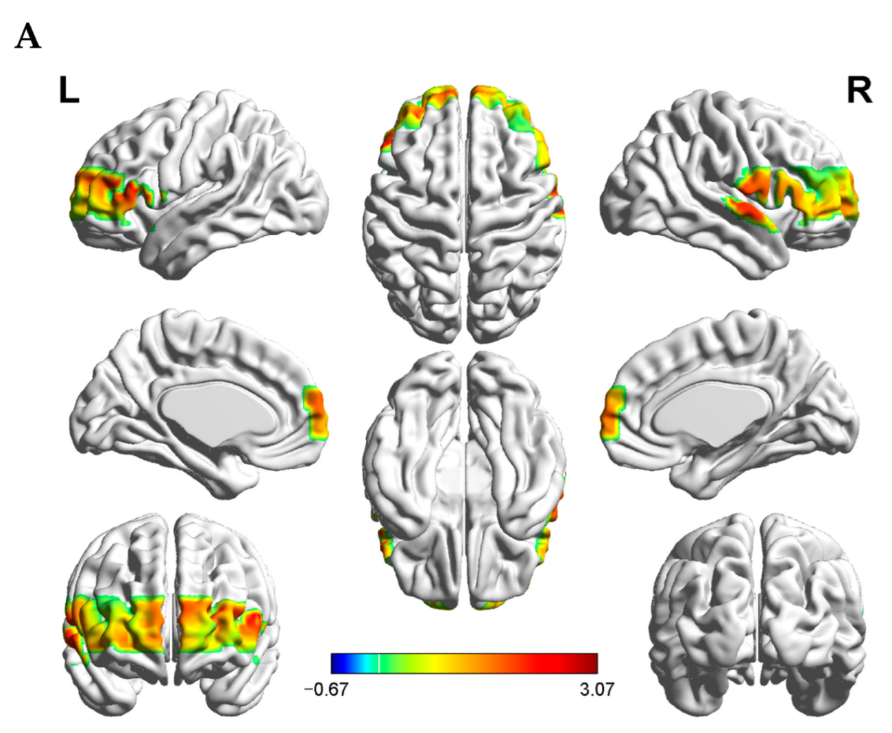 Brainsci 12 00635 g004a Brainsci 12 00635 g004a