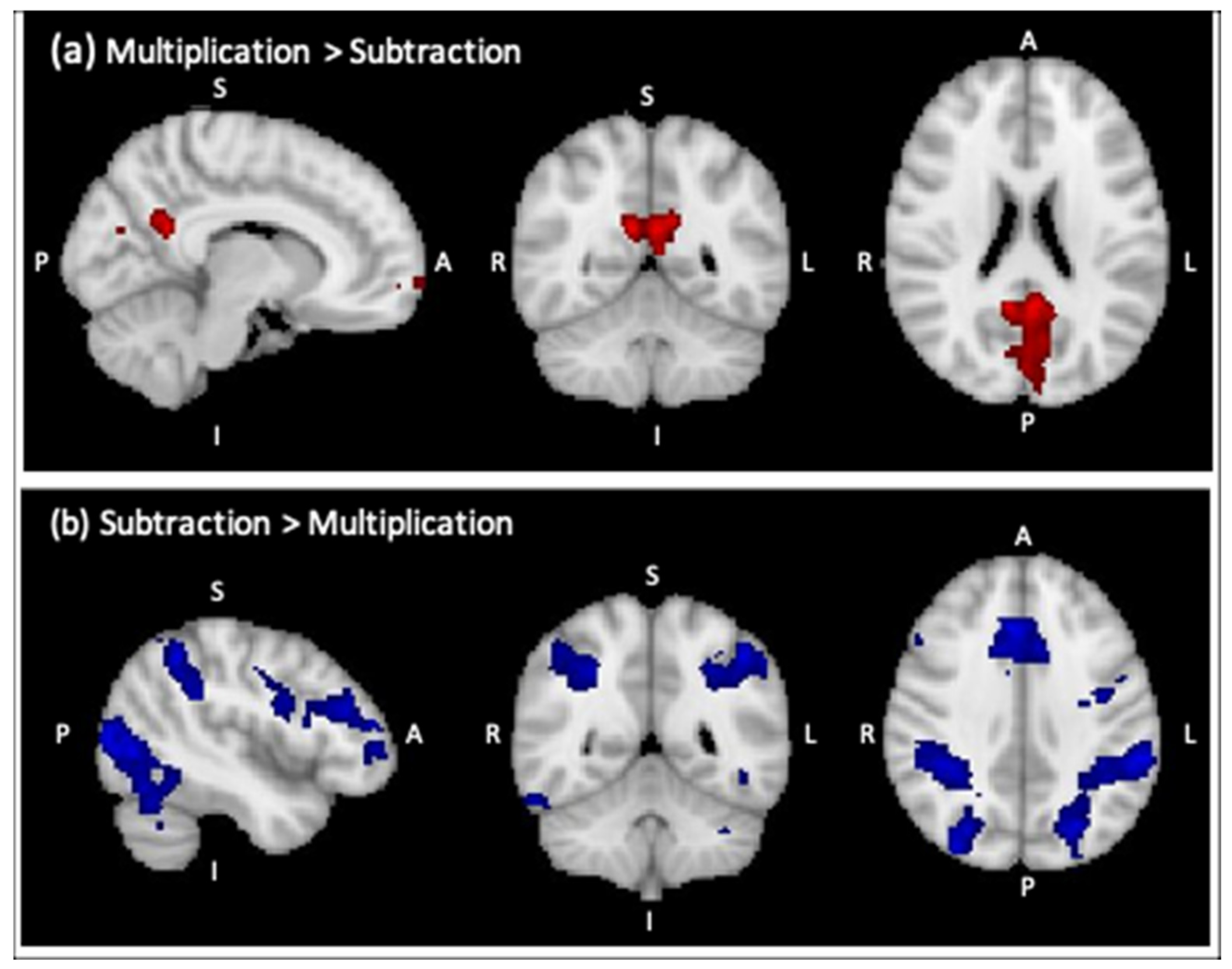 Brainsci 12 00735 g0a1