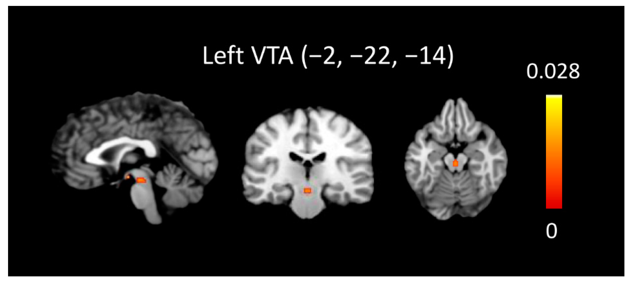 Brainsci 12 00830 g003 Brainsci 12 00830 g003