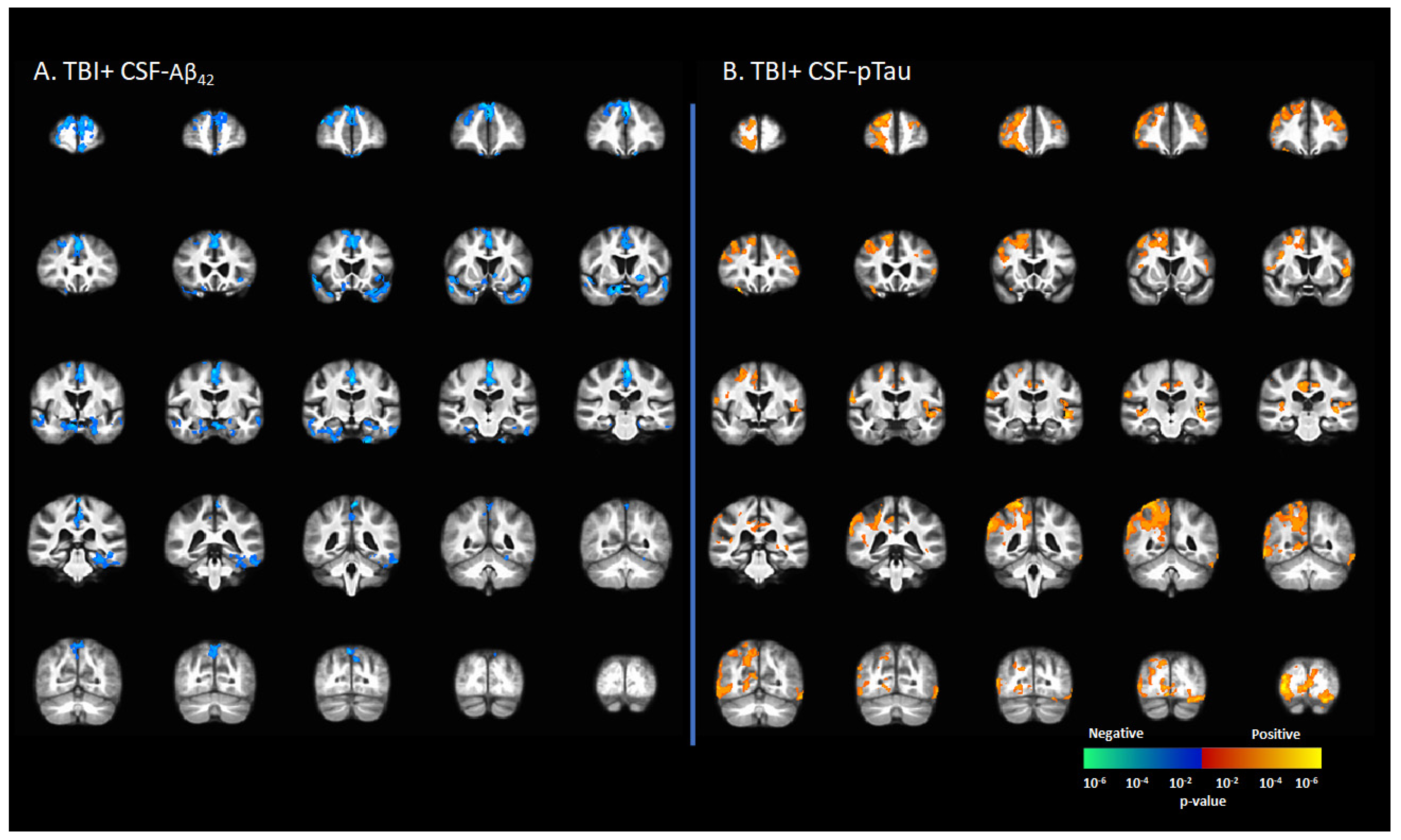 Brainsci 12 00876 g004
