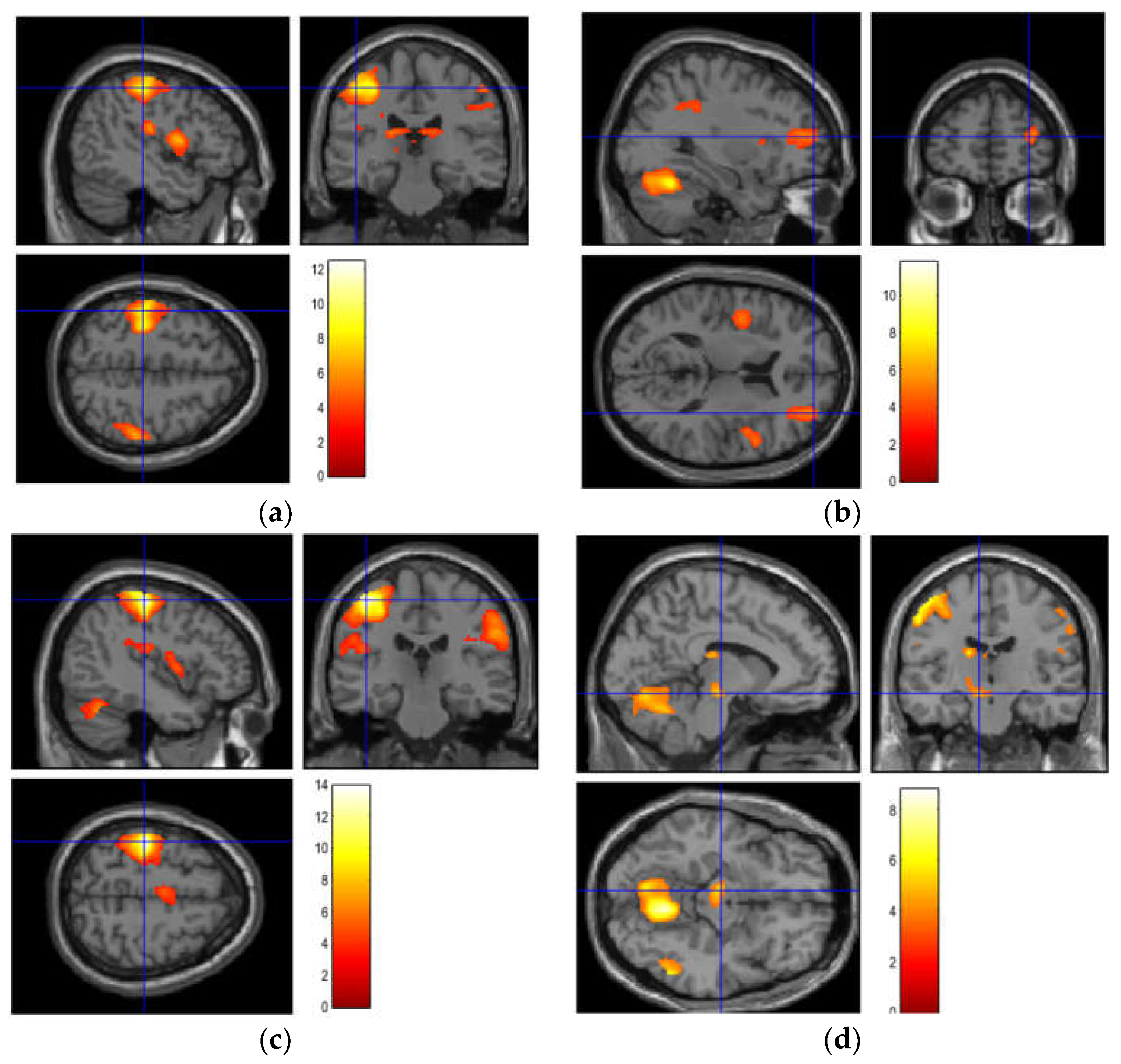 Brainsci 12 00924 g004