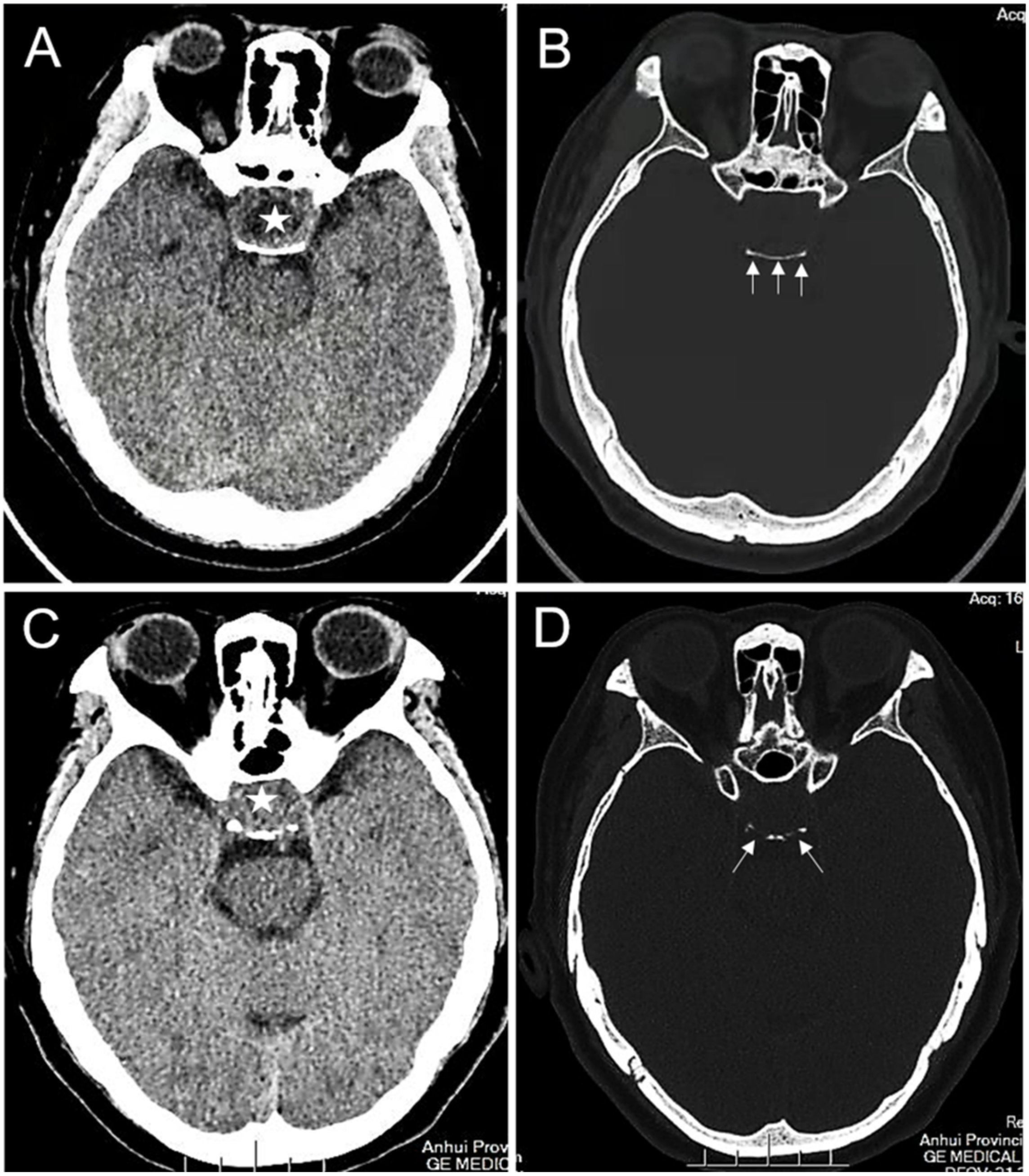 Brainsci 12 01002 g002 Brainsci 12 01002 g002