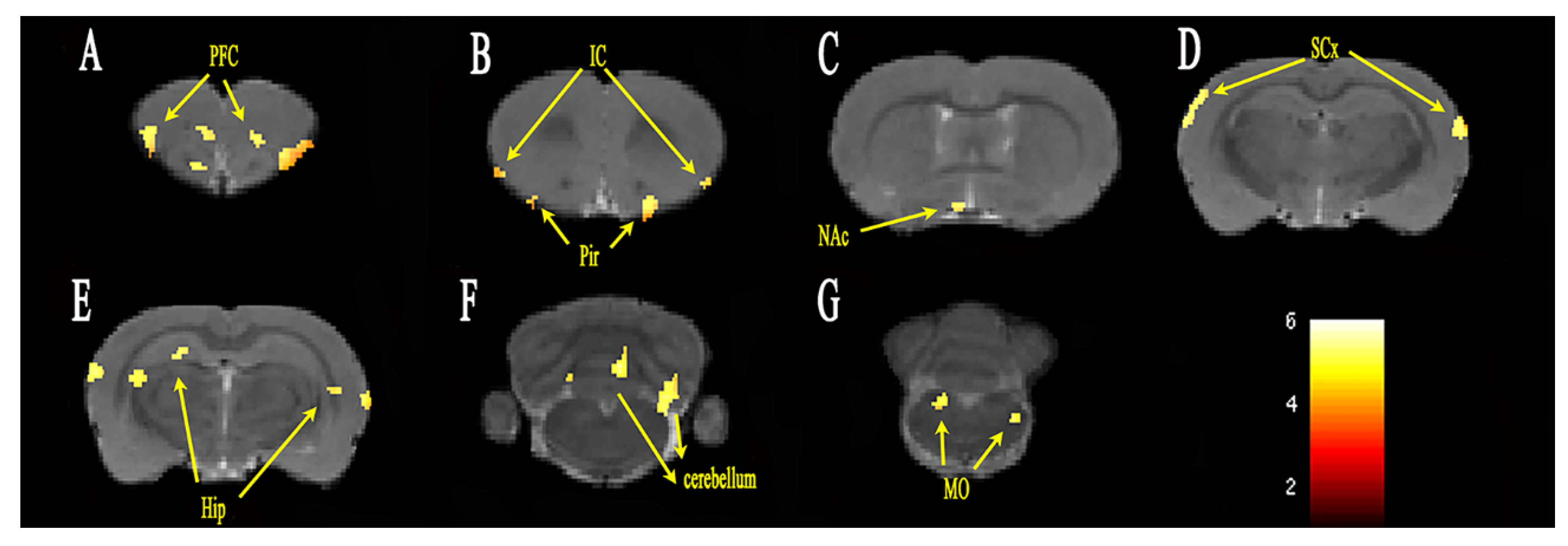 Brainsci 12 01029 g003