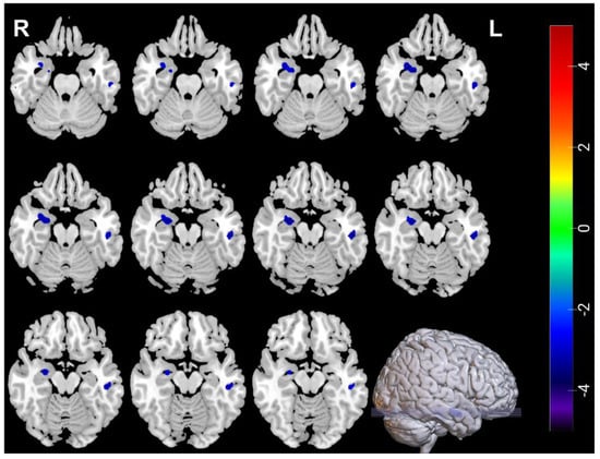 Left Brain - Right Brain Test - MS CHANG'S ART CLASSES