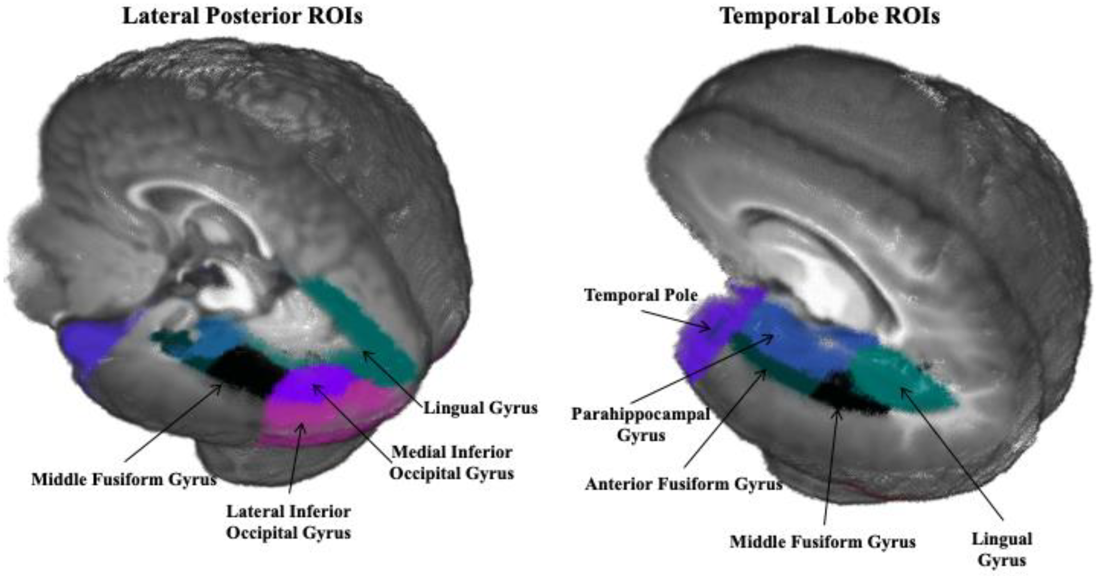 Brainsci 12 01129 g002