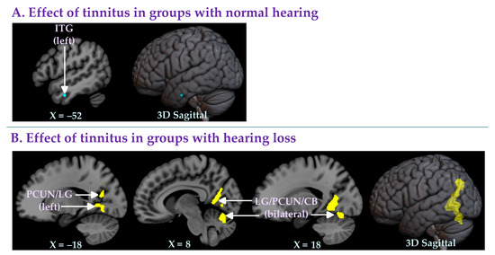 Brain Sciences Free Full Text A Combined Image And Coordinate Based Meta Analysis Of Whole 6894