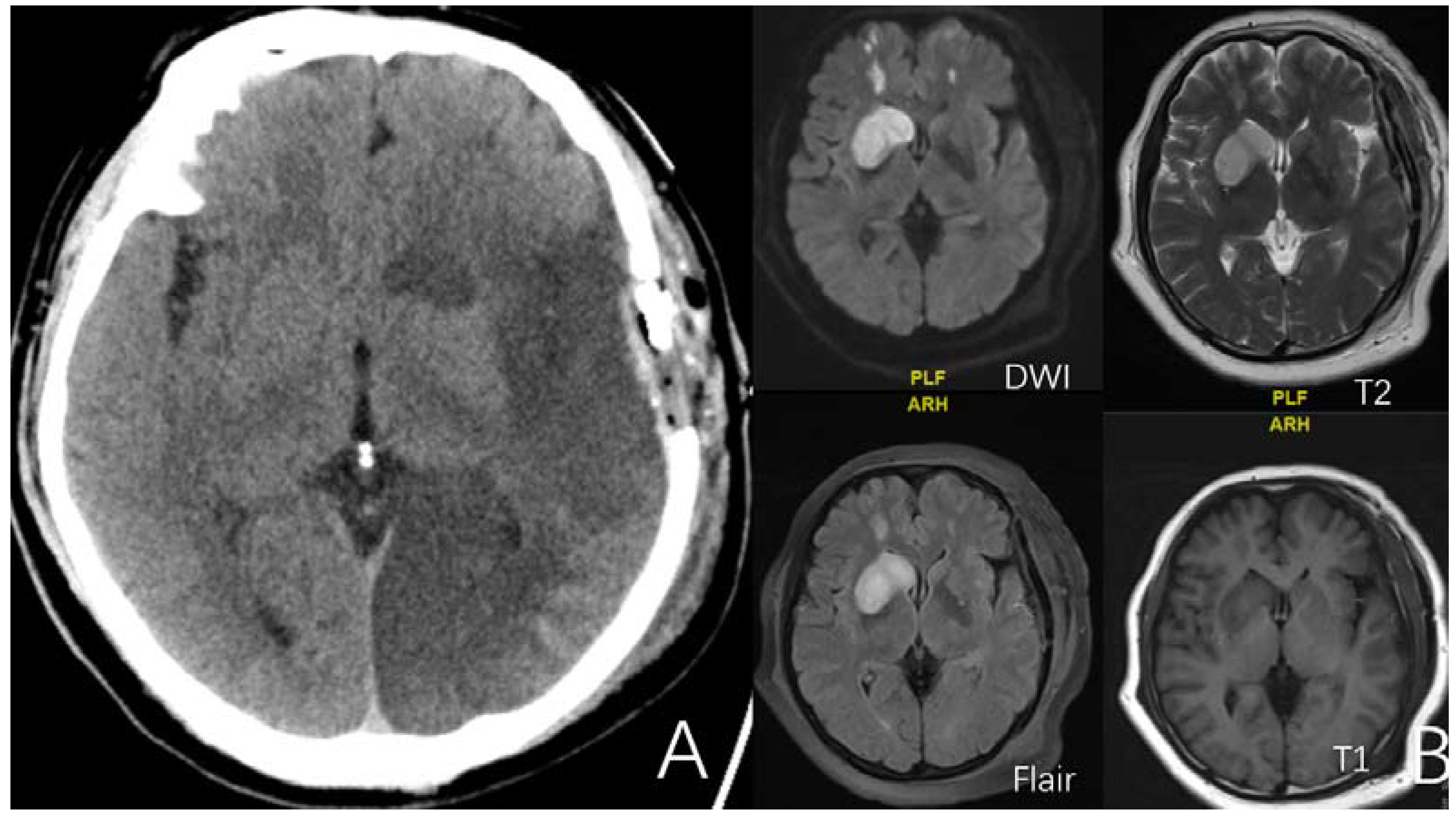Brainsci 12 01270 g002 Brainsci 12 01270 g002