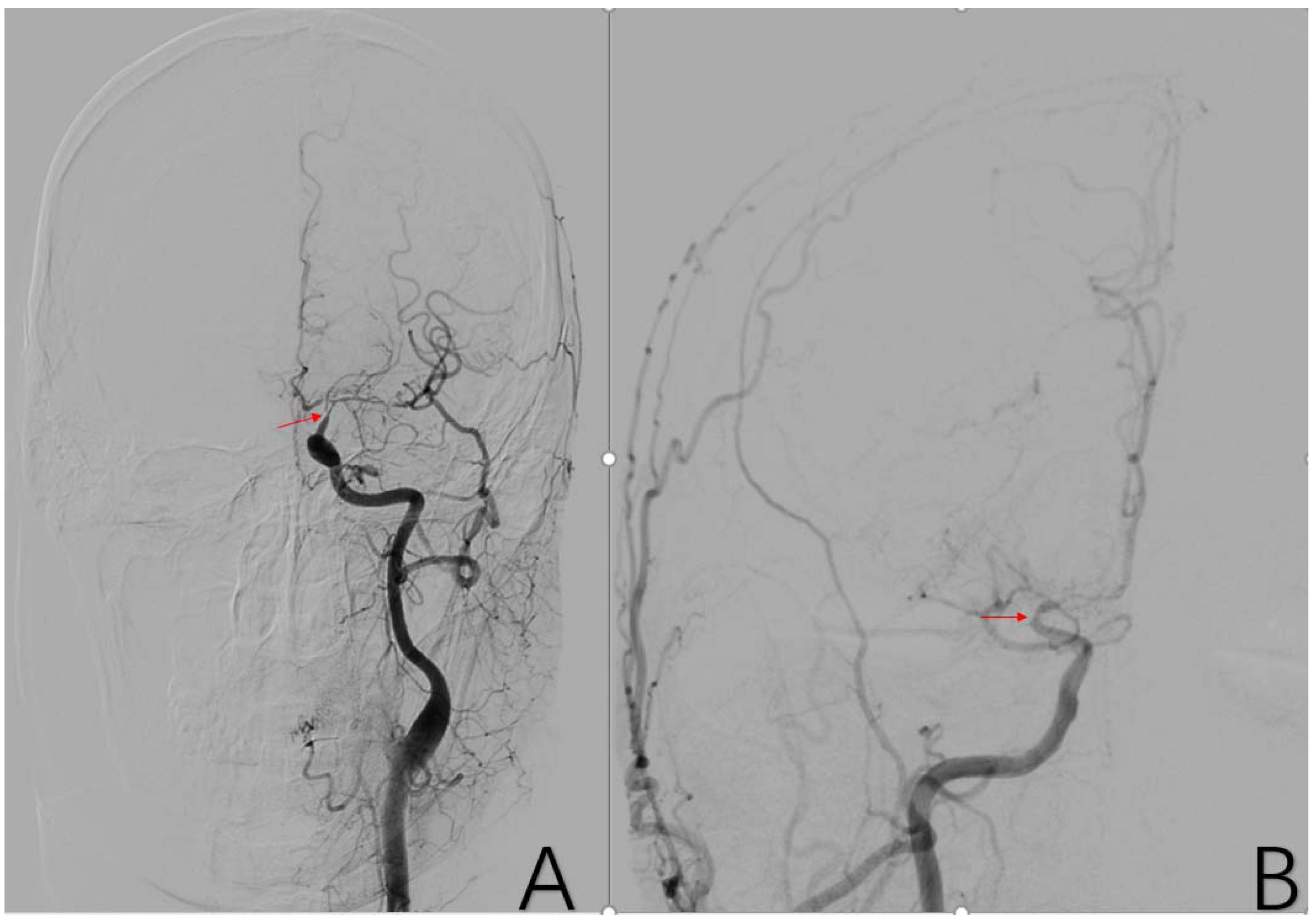 Brainsci 12 01270 g004 Brainsci 12 01270 g004