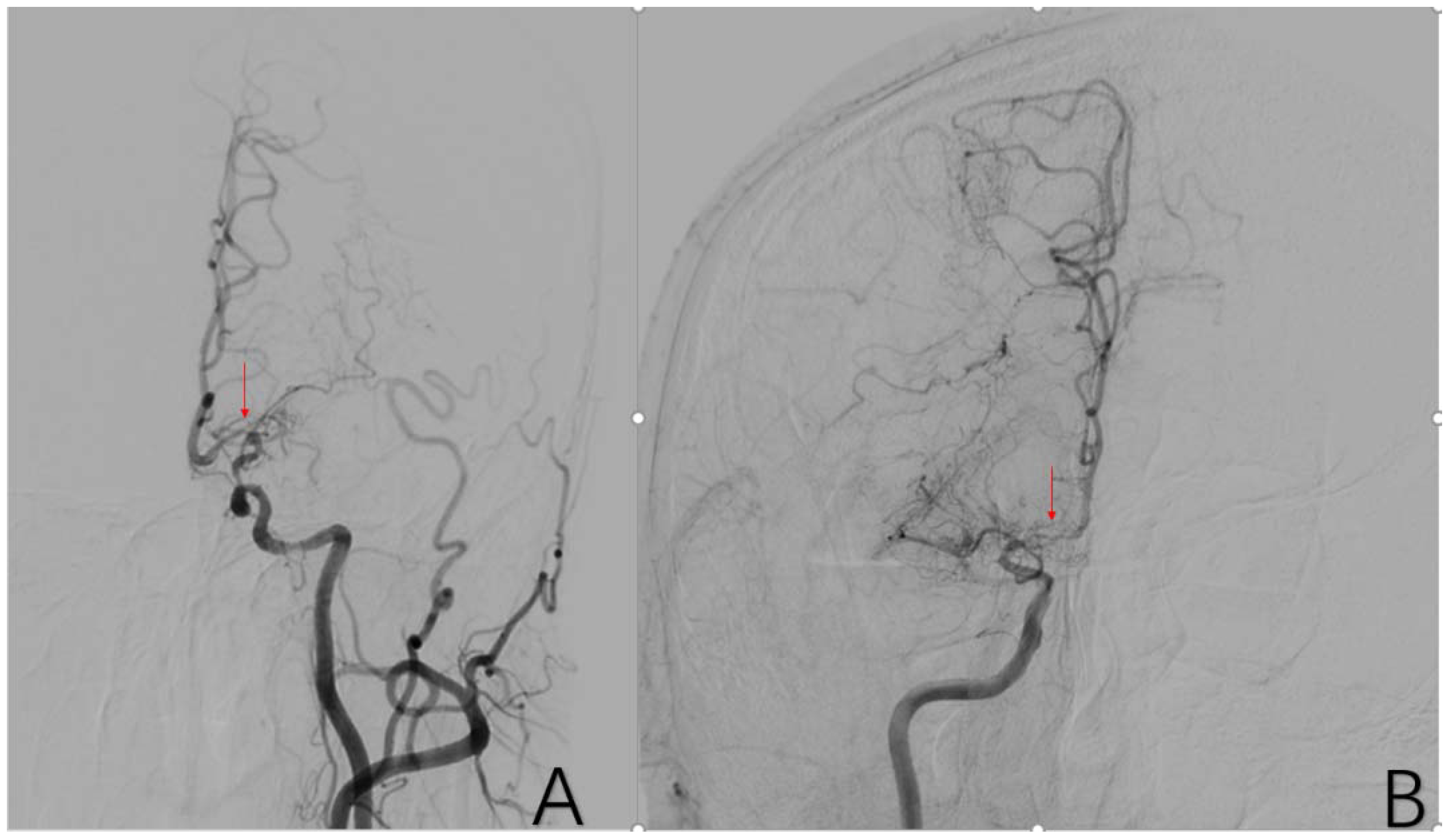 Brainsci 12 01270 g005 Brainsci 12 01270 g005