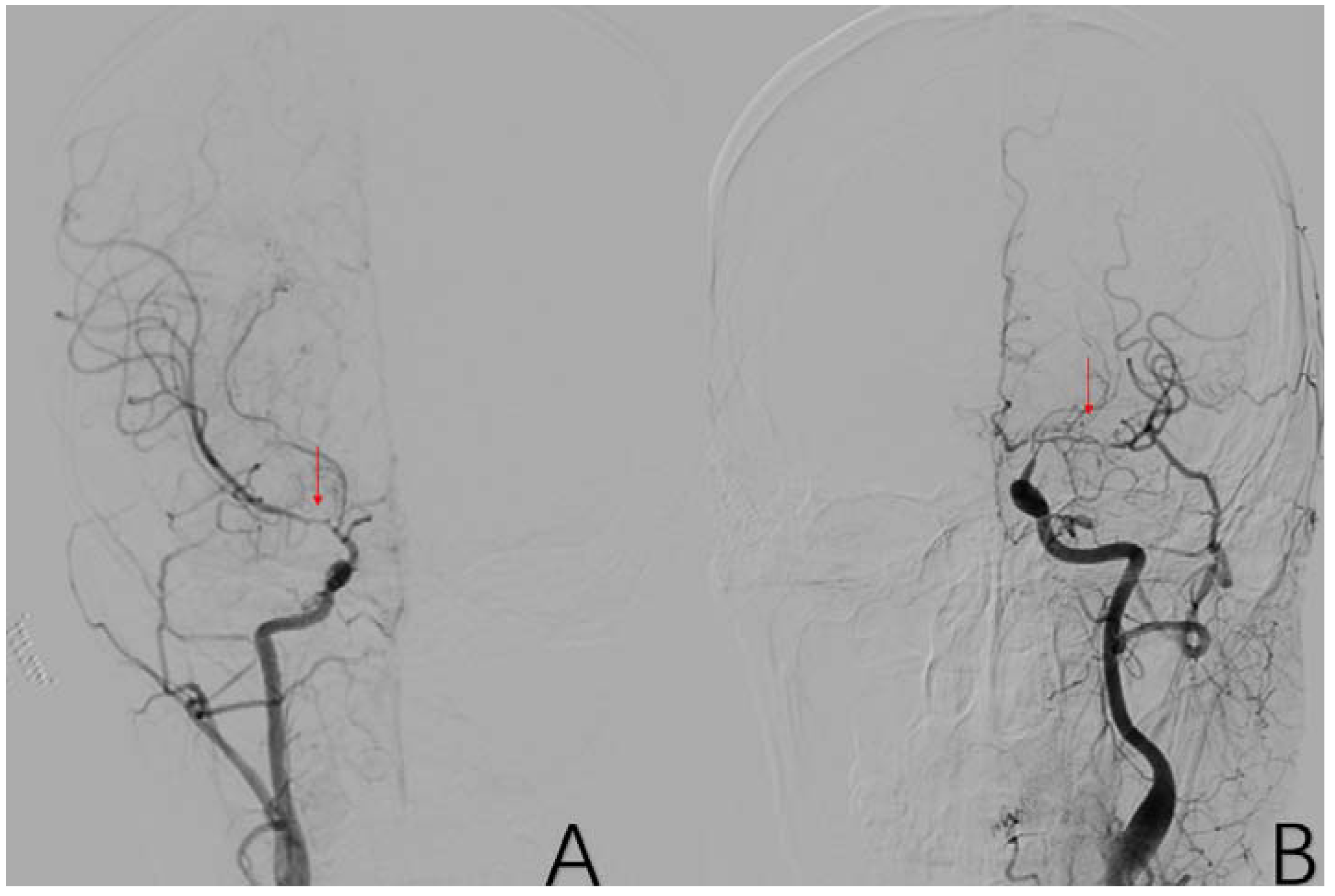 Brainsci 12 01270 g006 Brainsci 12 01270 g006