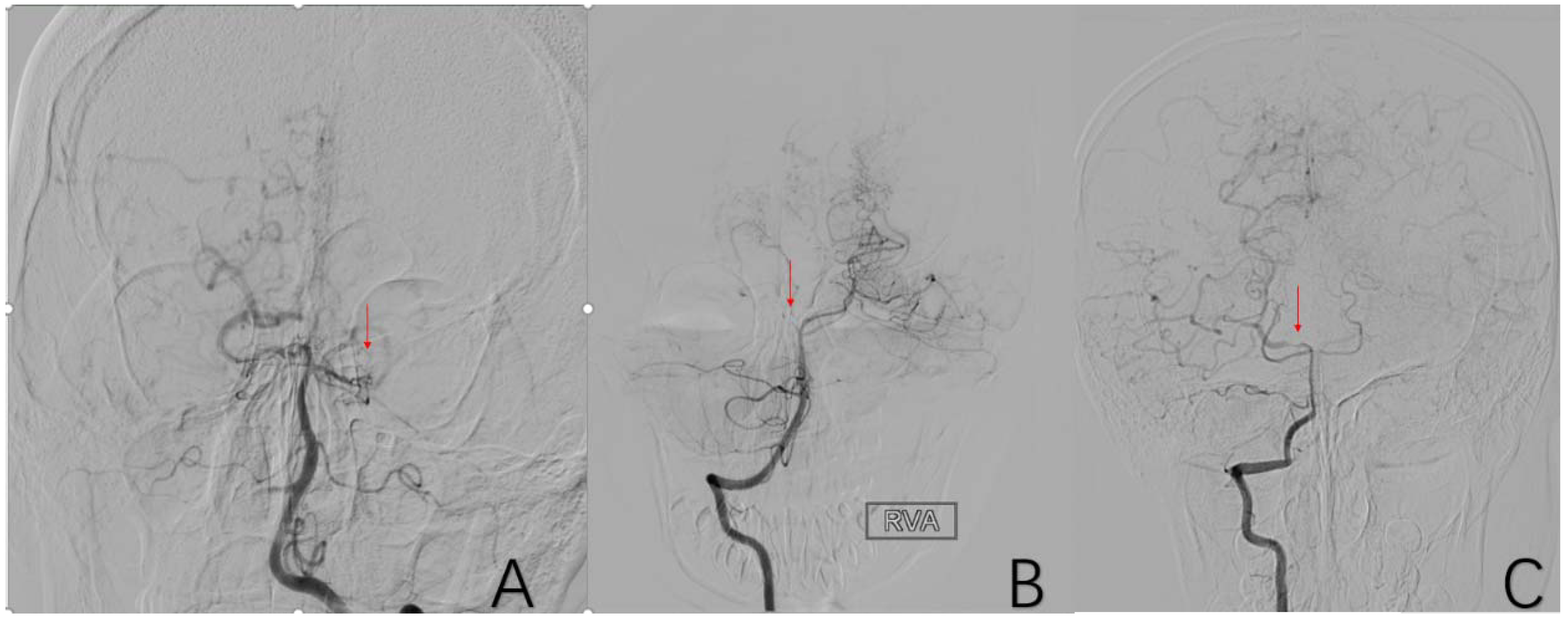 Brainsci 12 01270 g007 Brainsci 12 01270 g007