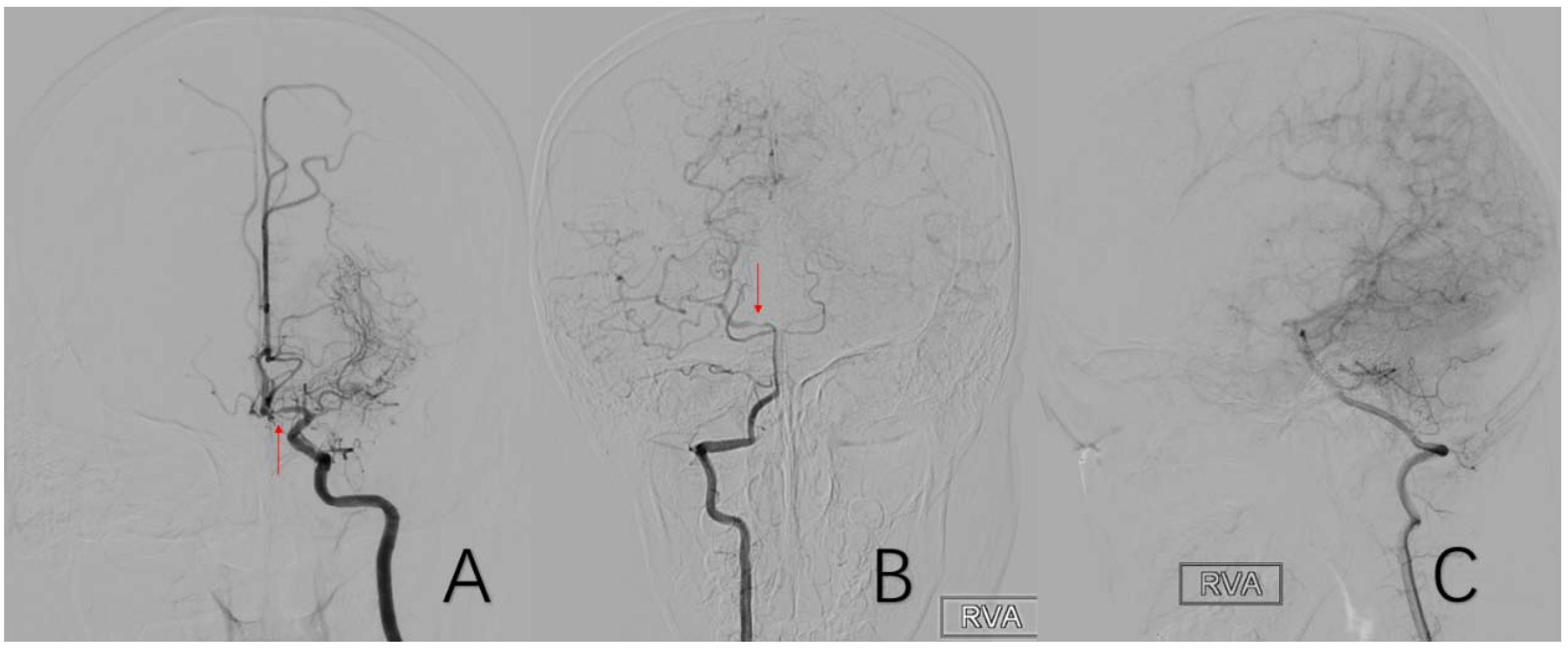 Brainsci 12 01270 g009 Brainsci 12 01270 g009