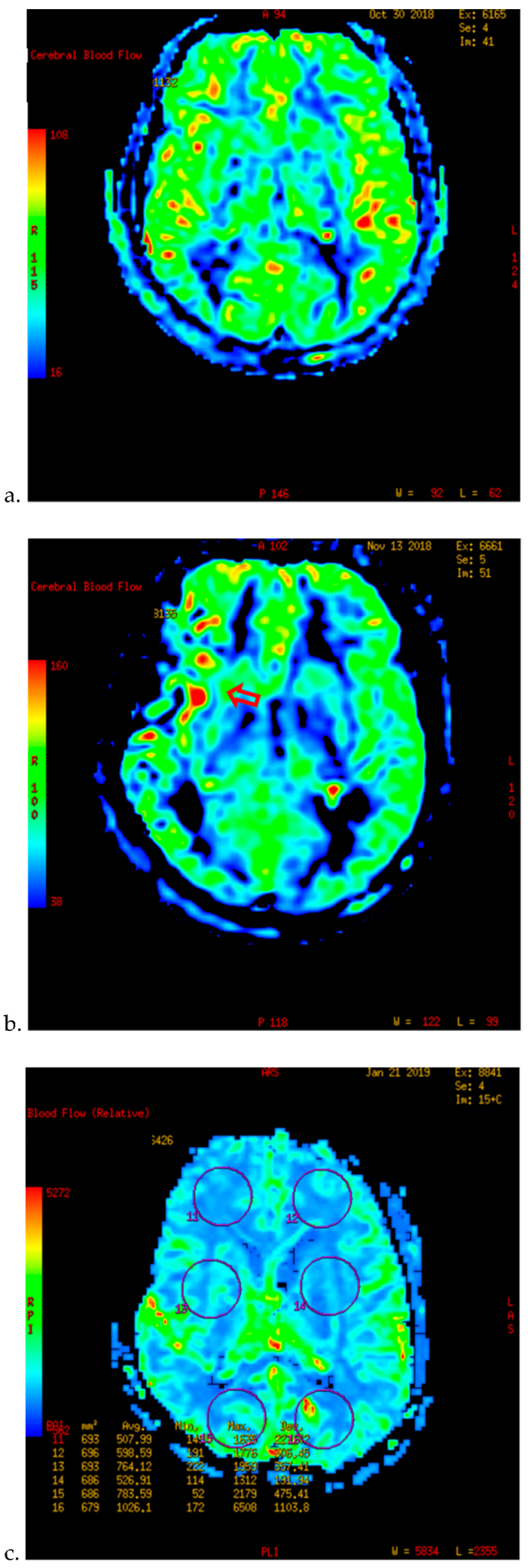 Brainsci 12 01285 g001 Brainsci 12 01285 g001