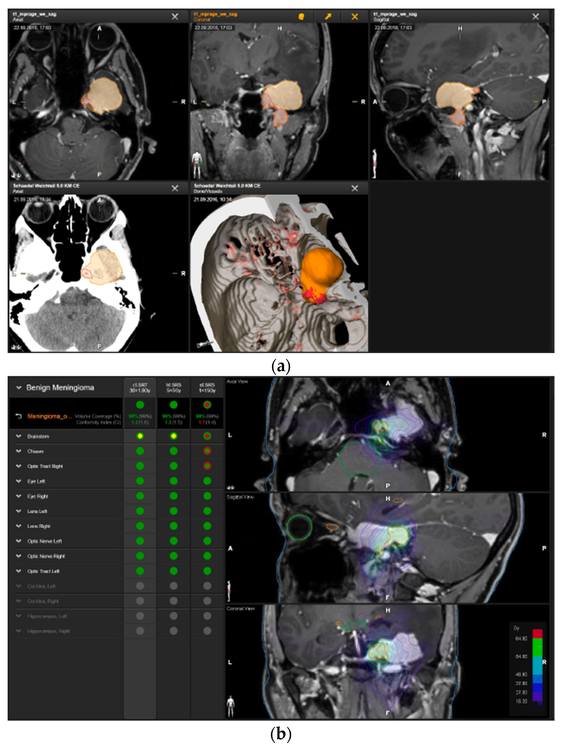 Brainsci 12 01326 g003a Brainsci 12 01326 g003a