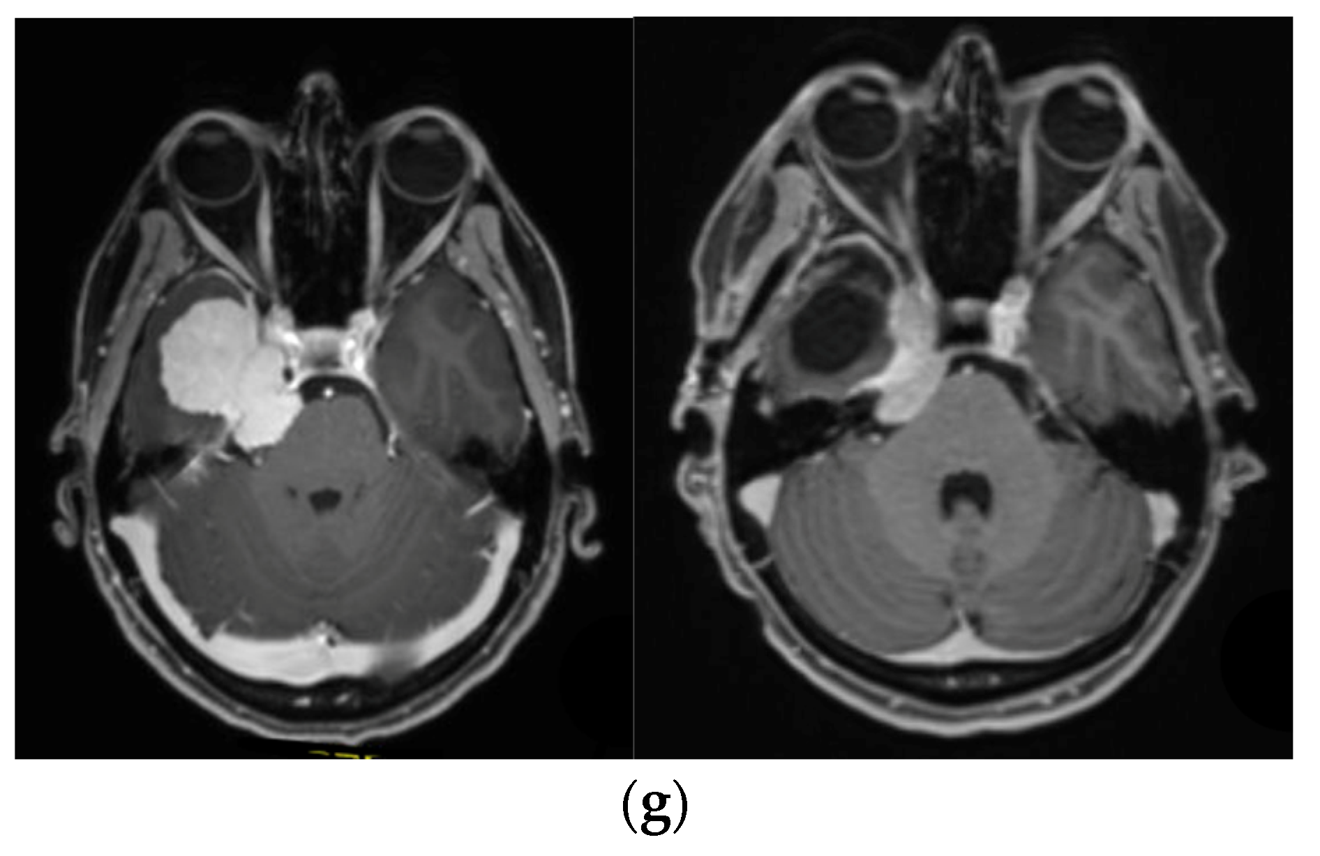 Brainsci 12 01326 g003d Brainsci 12 01326 g003d