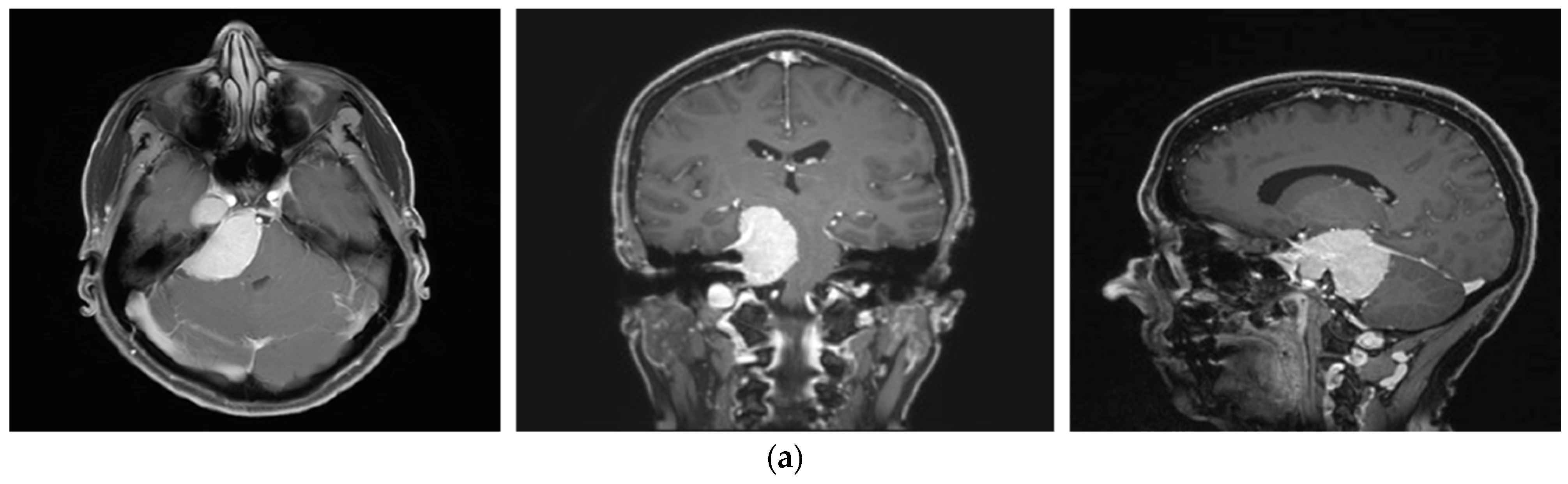 Brainsci 12 01326 g004a Brainsci 12 01326 g004a