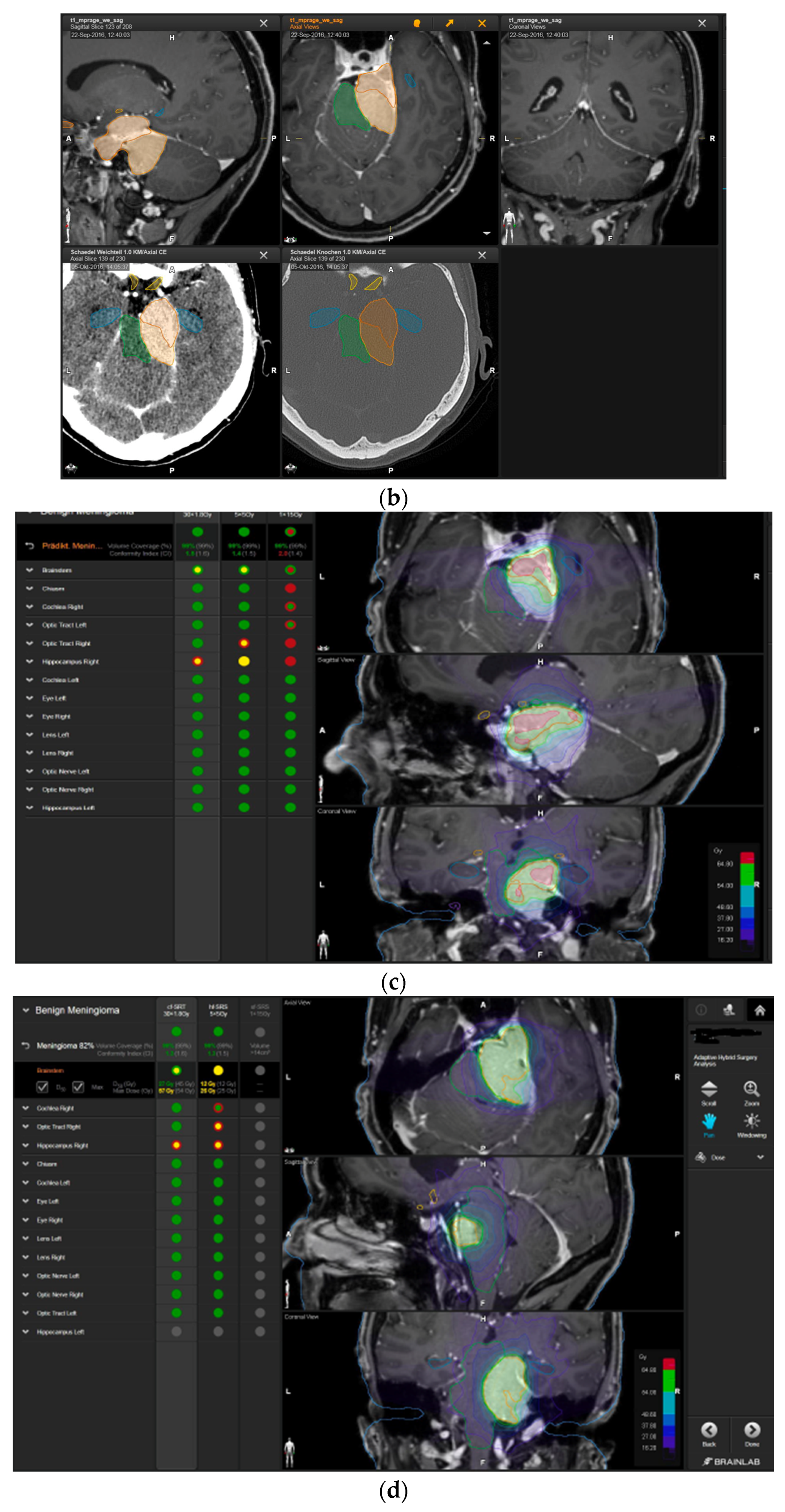 Brainsci 12 01326 g004b Brainsci 12 01326 g004b