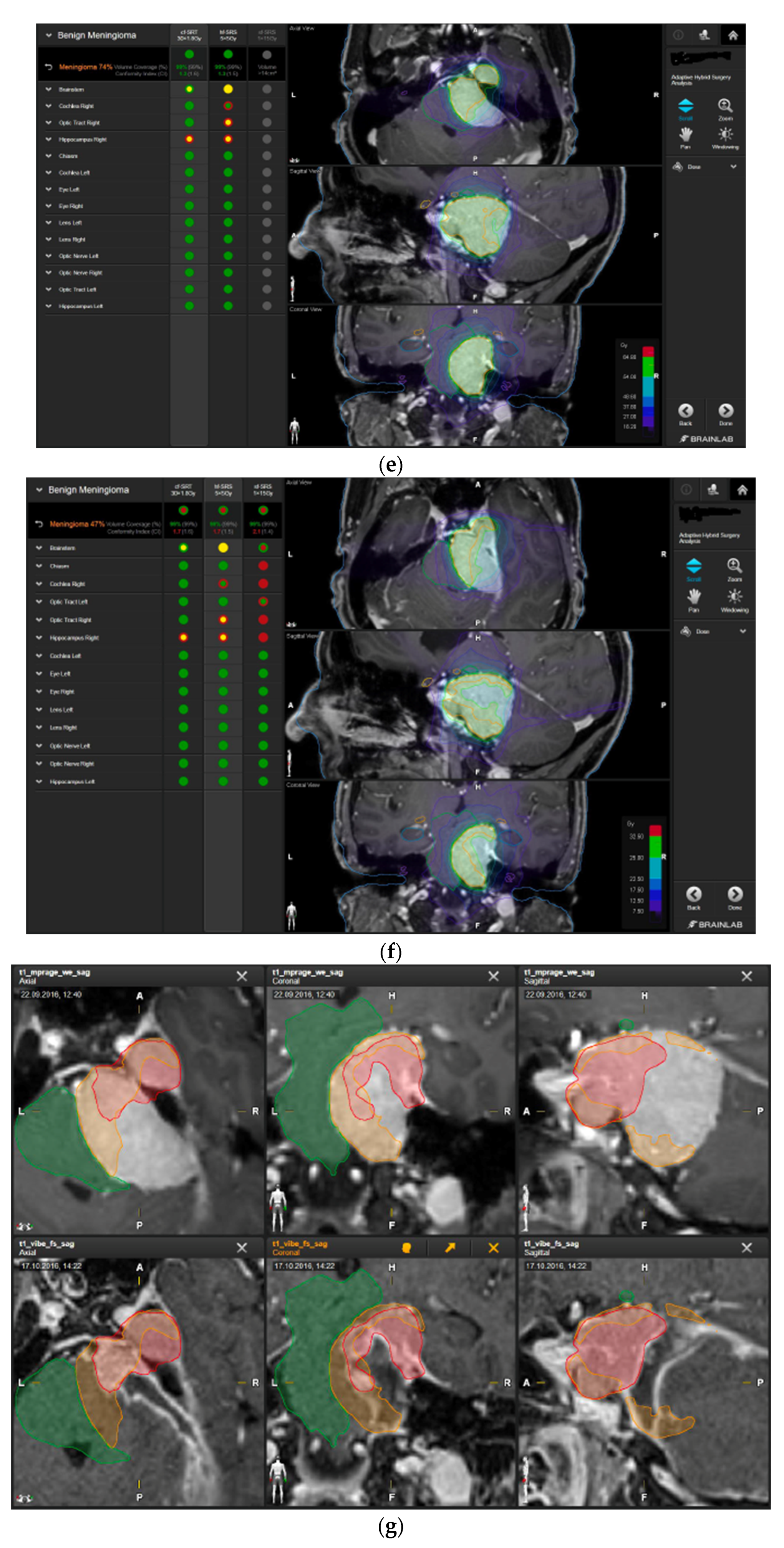 Brainsci 12 01326 g004c Brainsci 12 01326 g004c