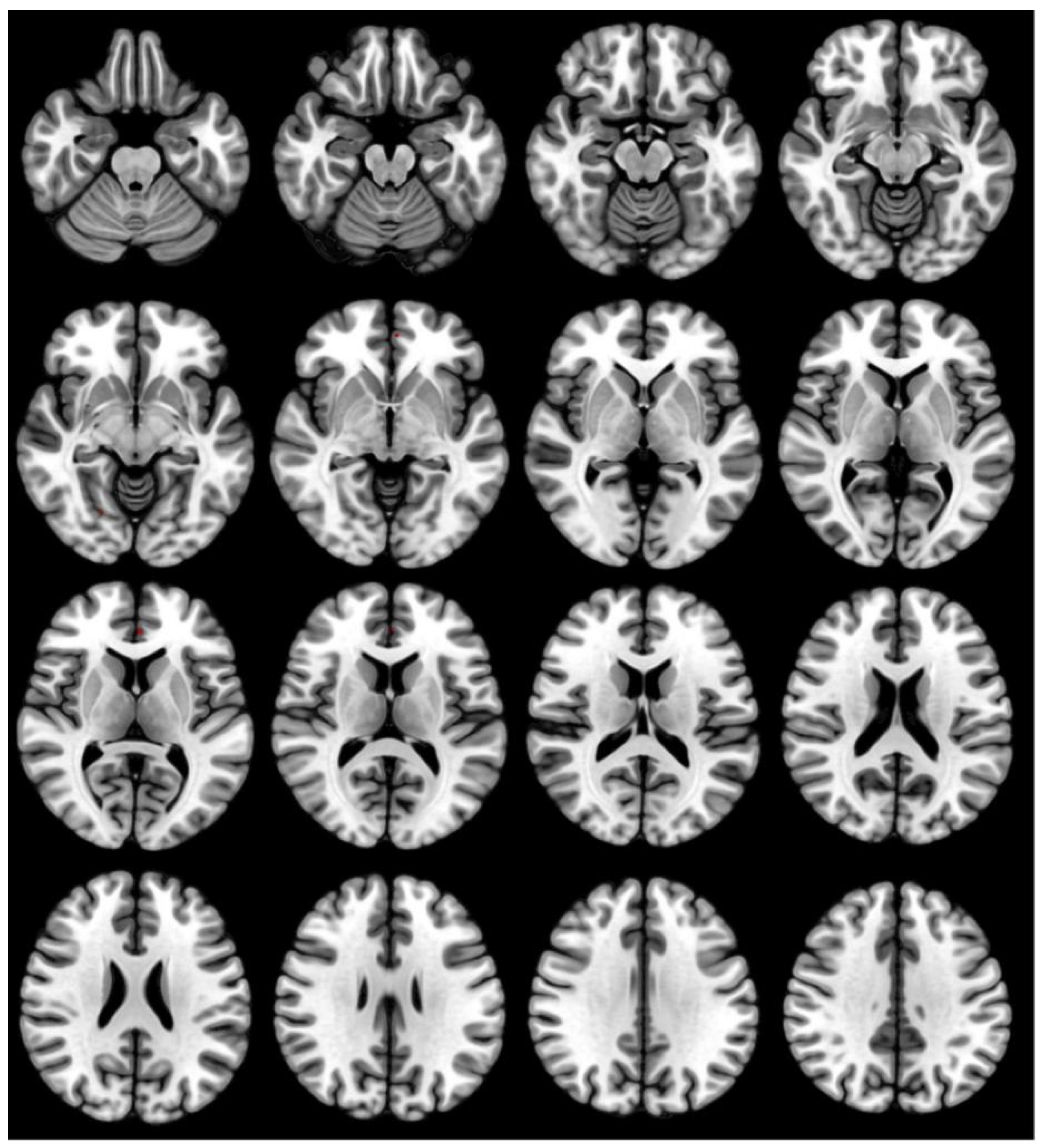 Brainsci 12 01534 g004