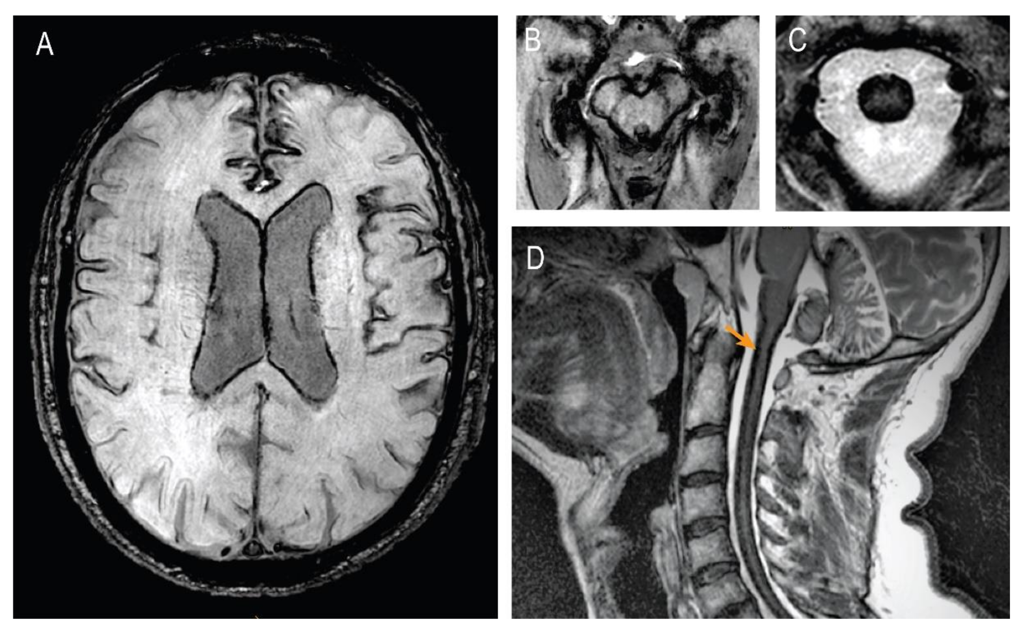 Brainsci 12 01558 g002 Brainsci 12 01558 g002