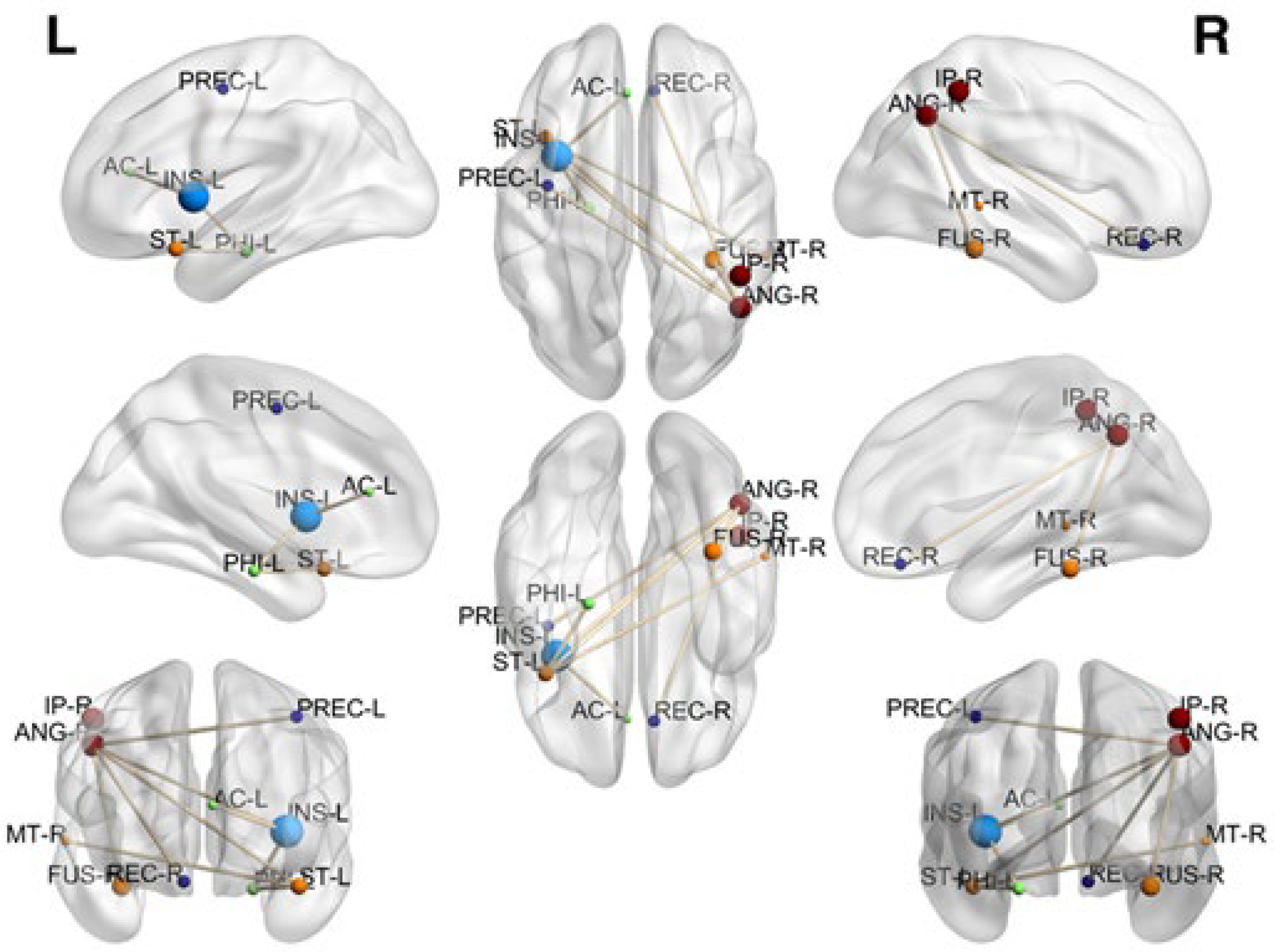 Brainsci 12 01574 g002 Brainsci 12 01574 g002
