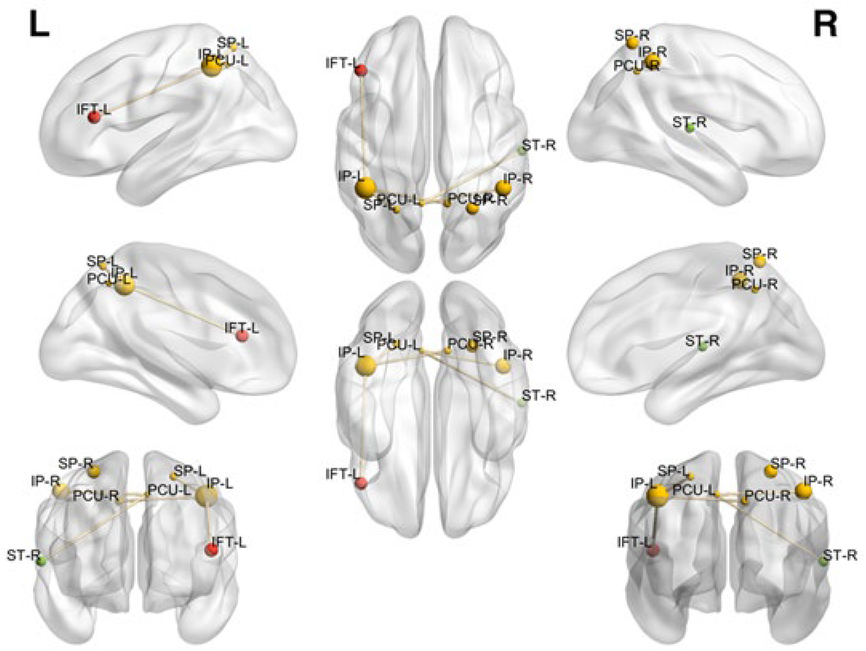 Brainsci 12 01574 g003 Brainsci 12 01574 g003