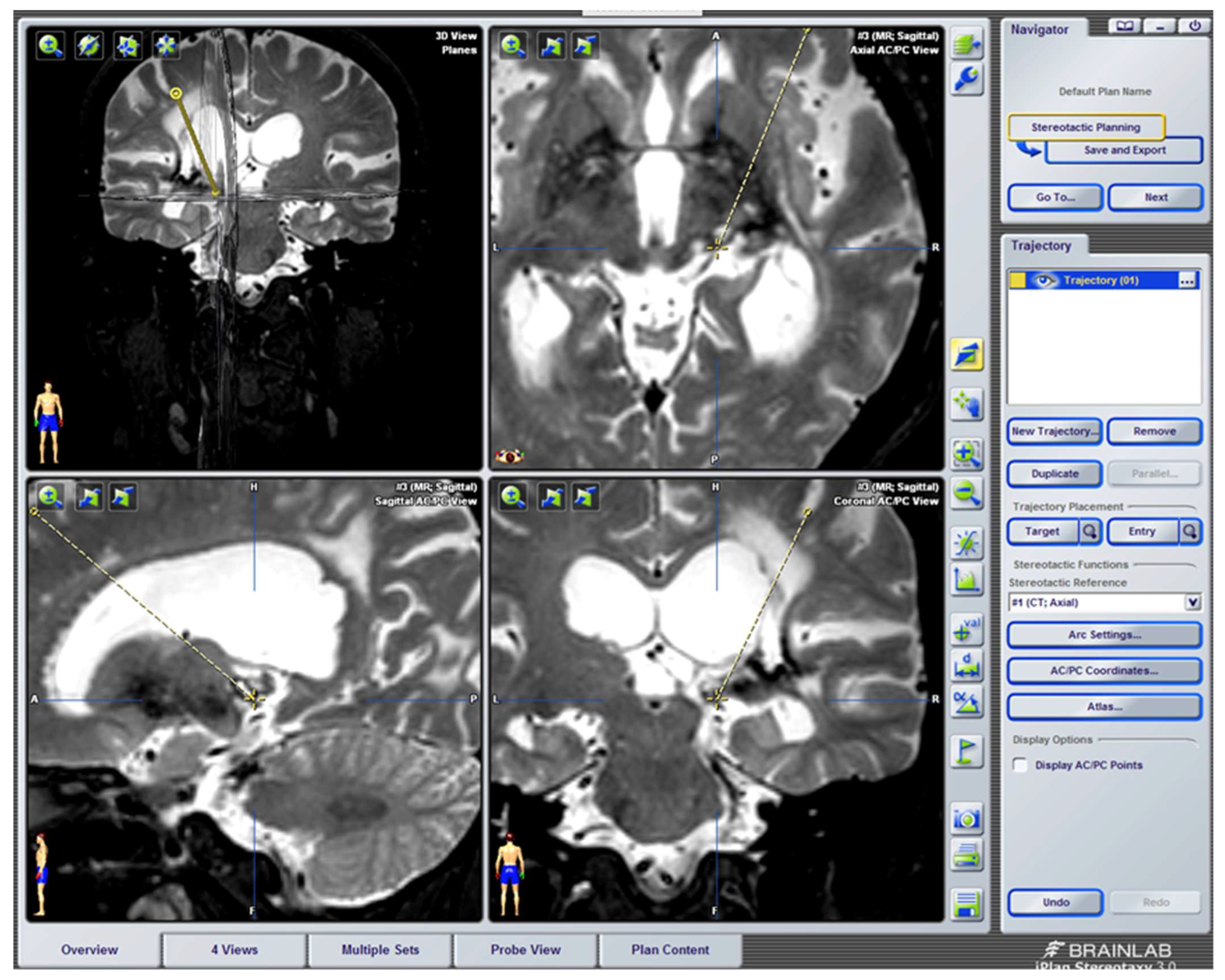 Dr. Edgar Martinez, MD, Springfield, MA, Radiologist