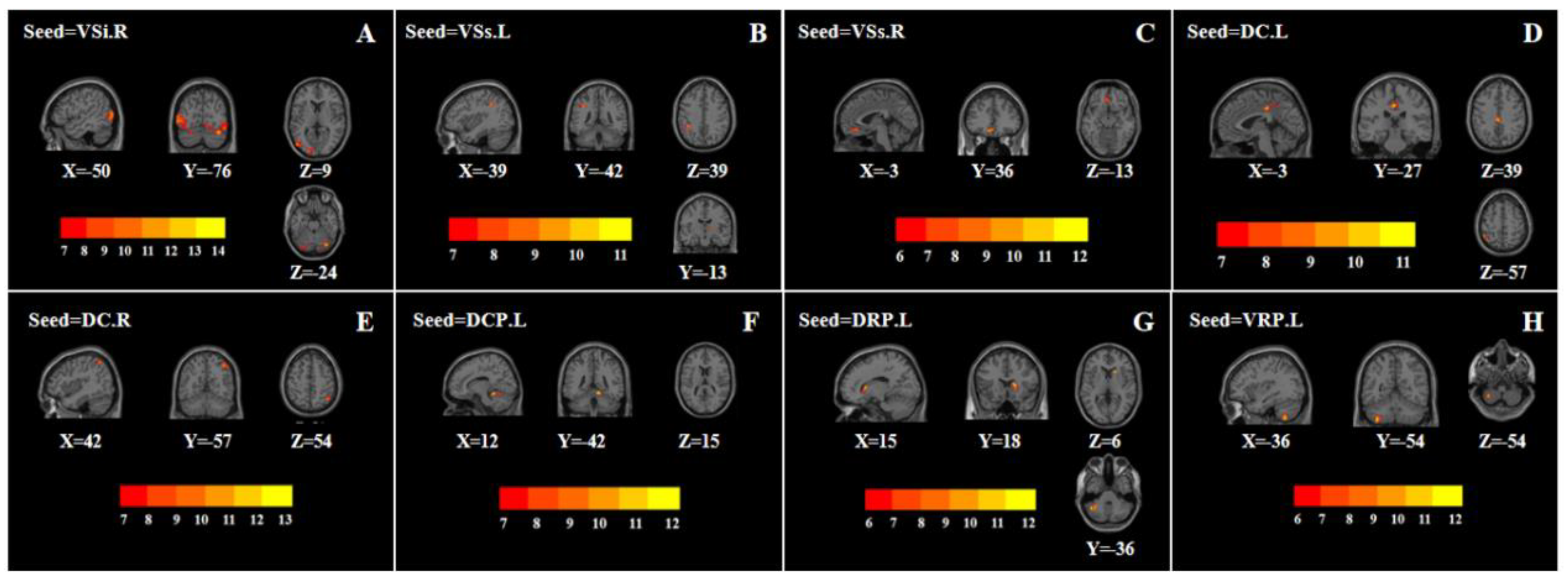 Brainsci 12 01603 g002 Brainsci 12 01603 g002