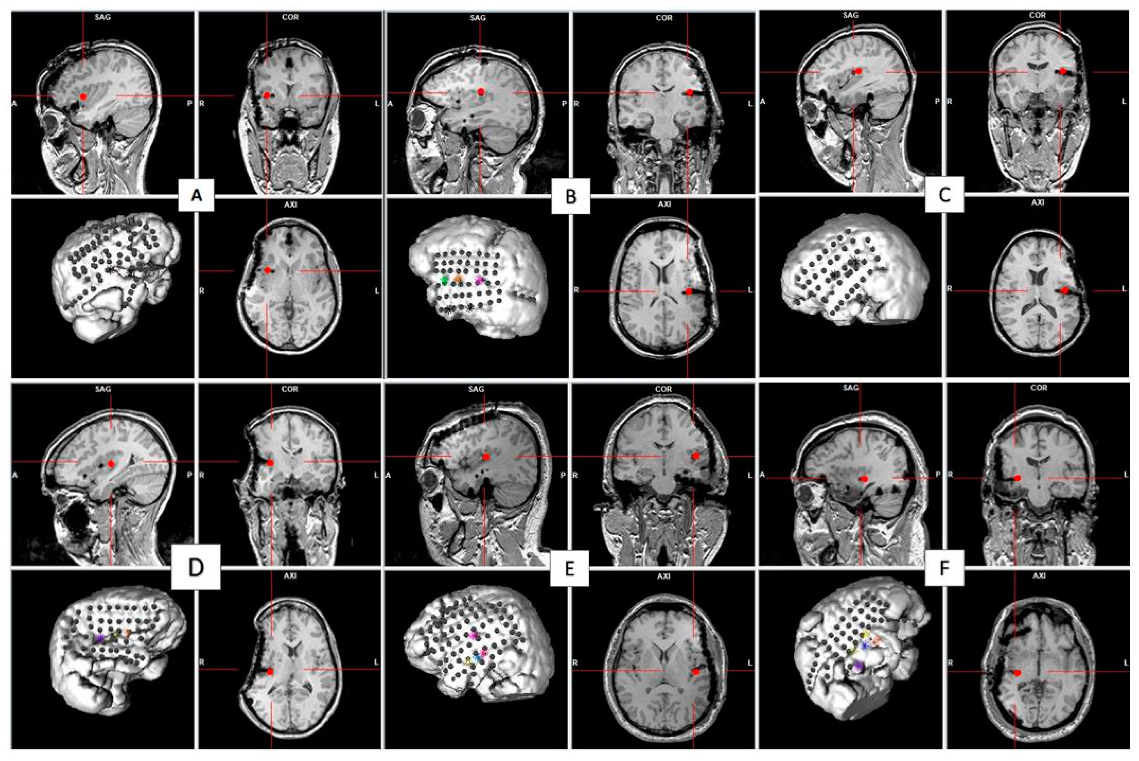 Brainsci 12 01616 g002