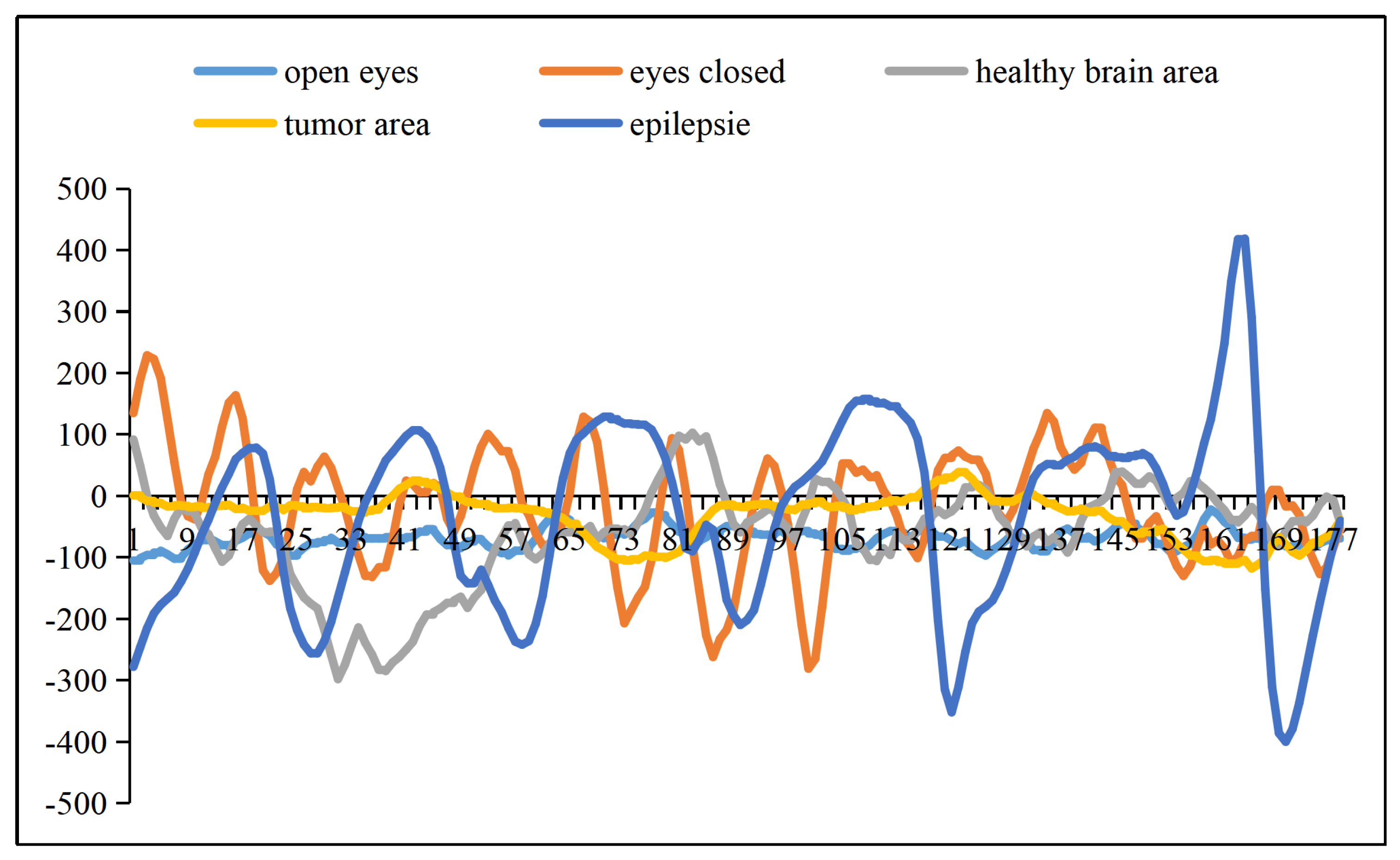 Eye closure sensitivity and epileptic syndromes: A retrospective